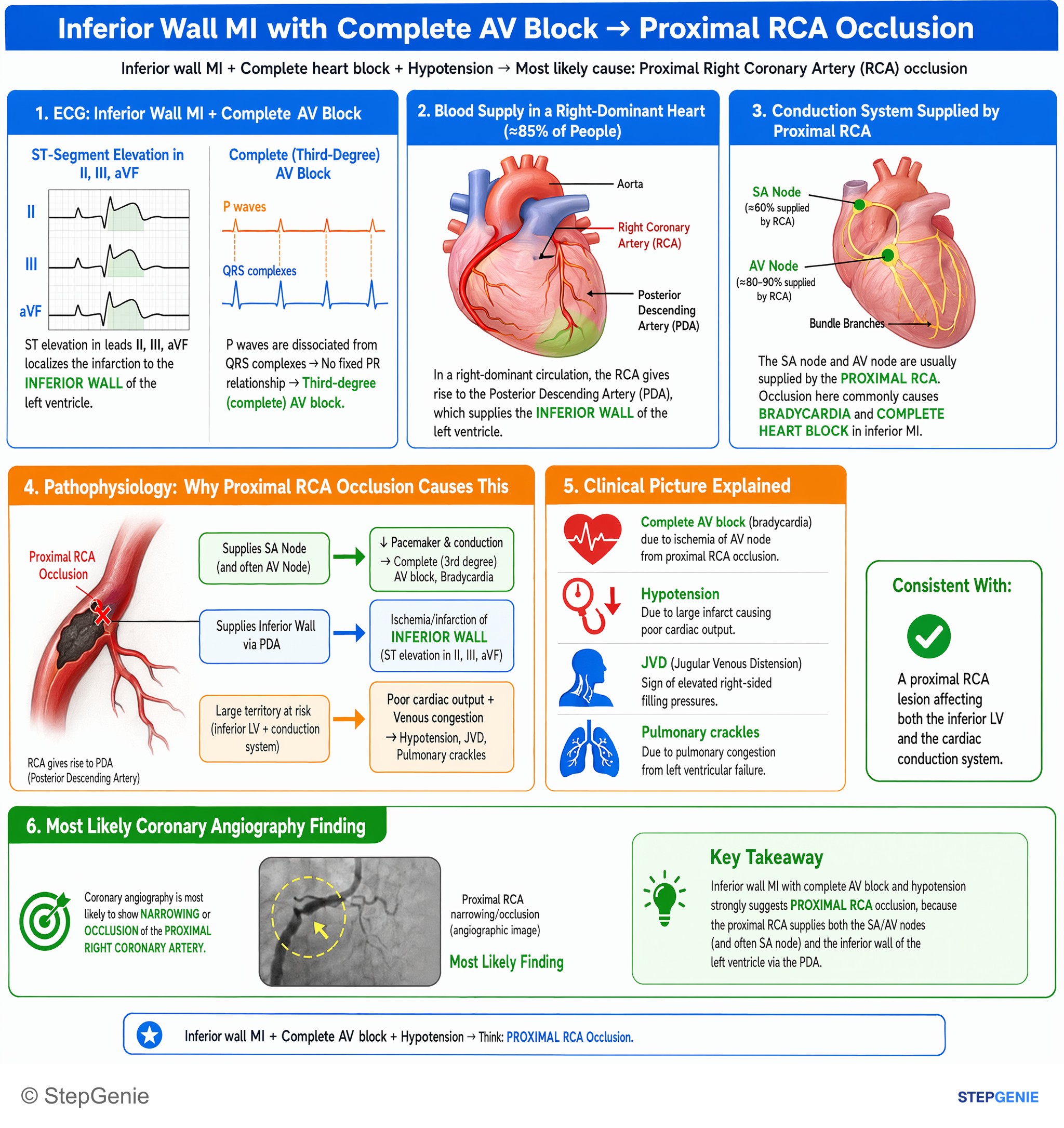 Ischemic heart disease — StepGenie USMLE Step 1 explanation infographic
