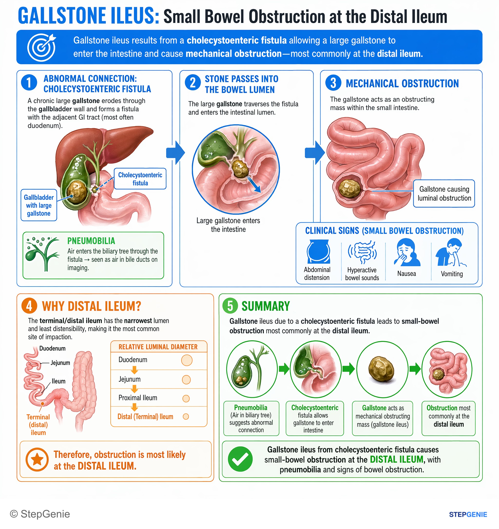 Biliary tract disorders — StepGenie USMLE Step 1 explanation infographic