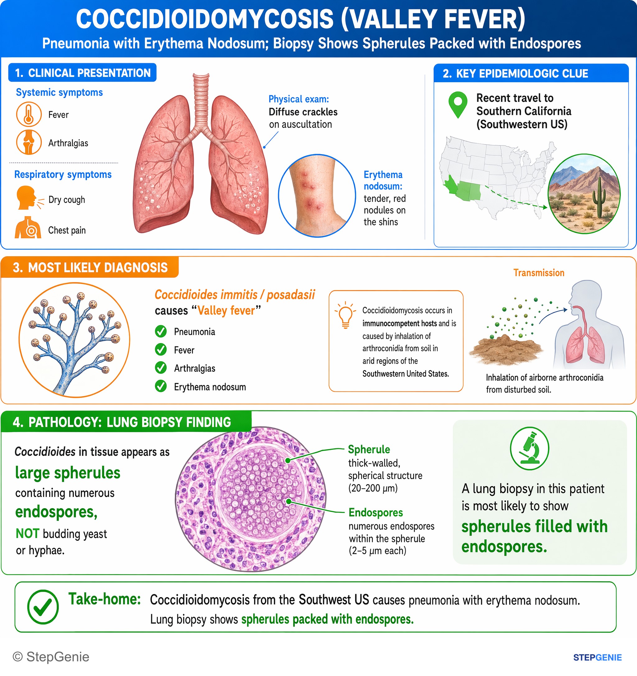 Pulmonary infections — StepGenie USMLE Step 1 explanation infographic
