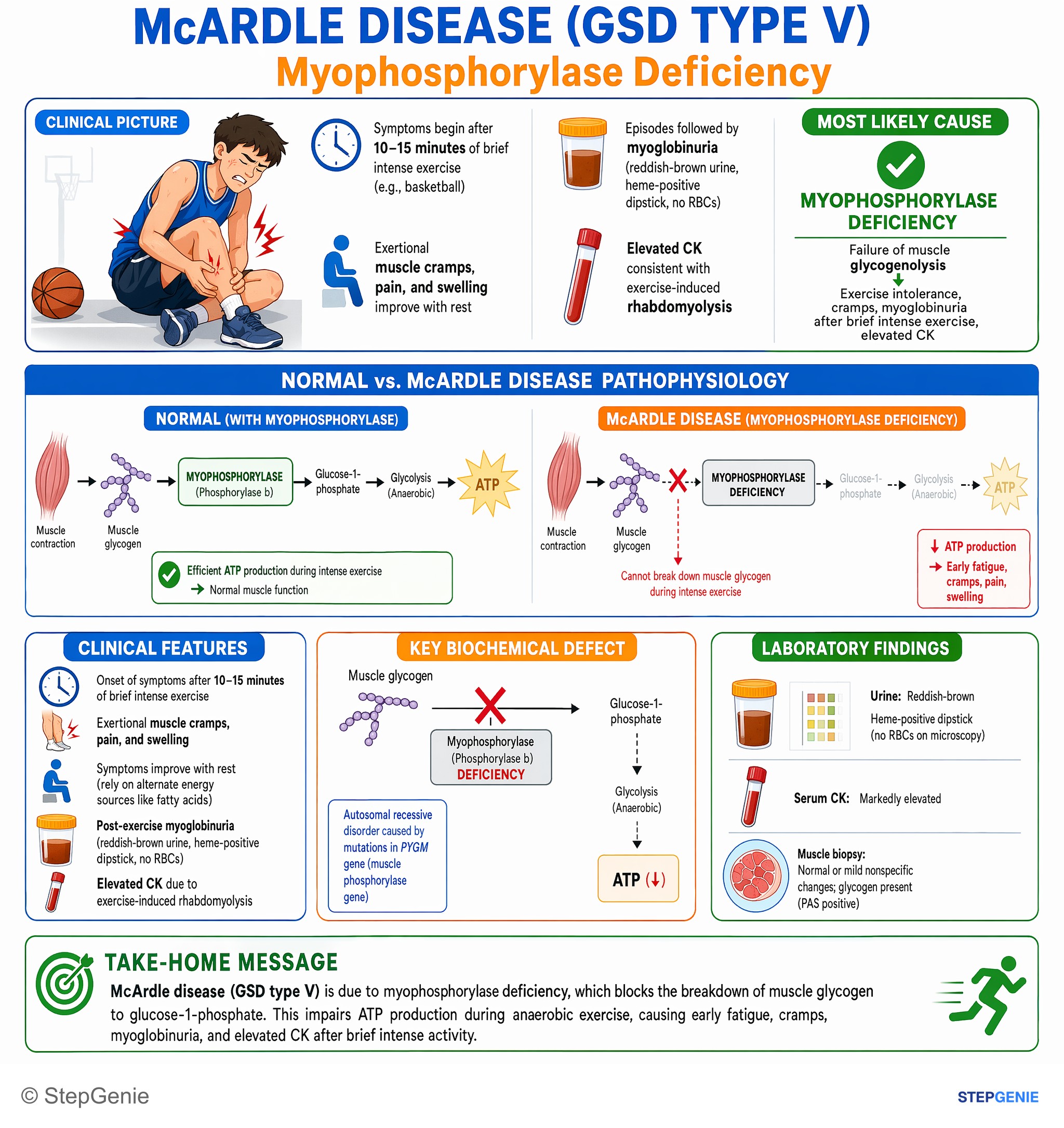 Glycogen storage diseases — StepGenie USMLE Step 1 explanation infographic