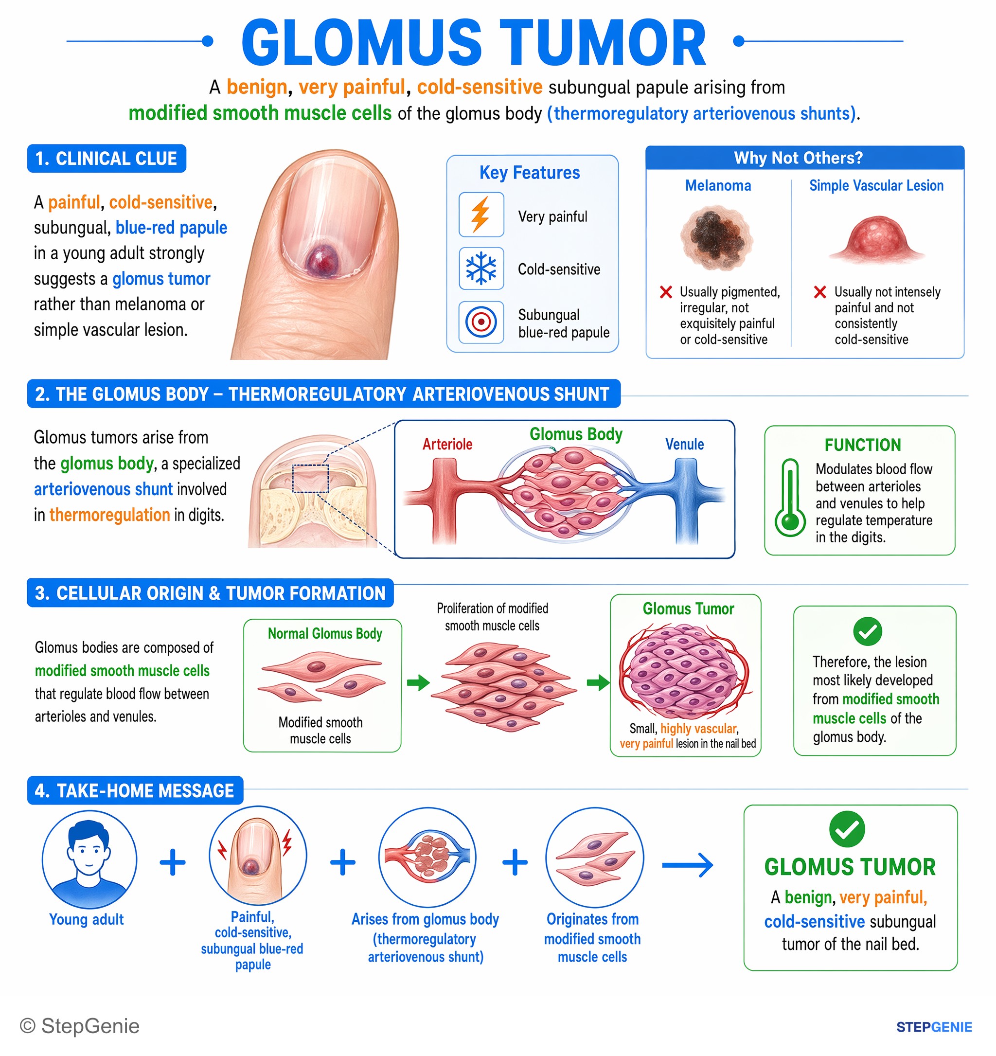 Neoplasia + tumor disorders — StepGenie USMLE Step 1 explanation infographic