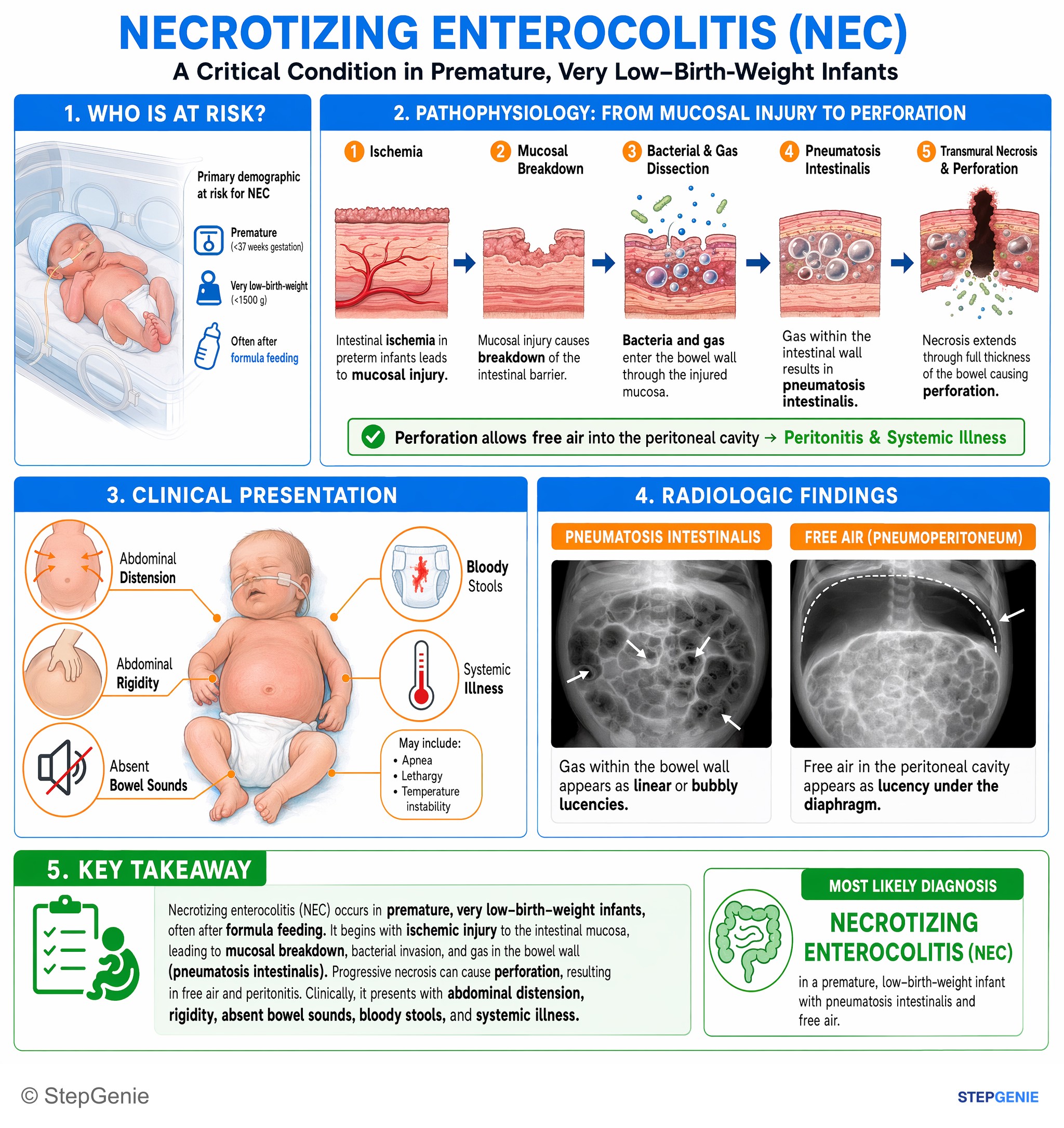 Intestinal and colorectal disorders — StepGenie USMLE Step 2 explanation infographic