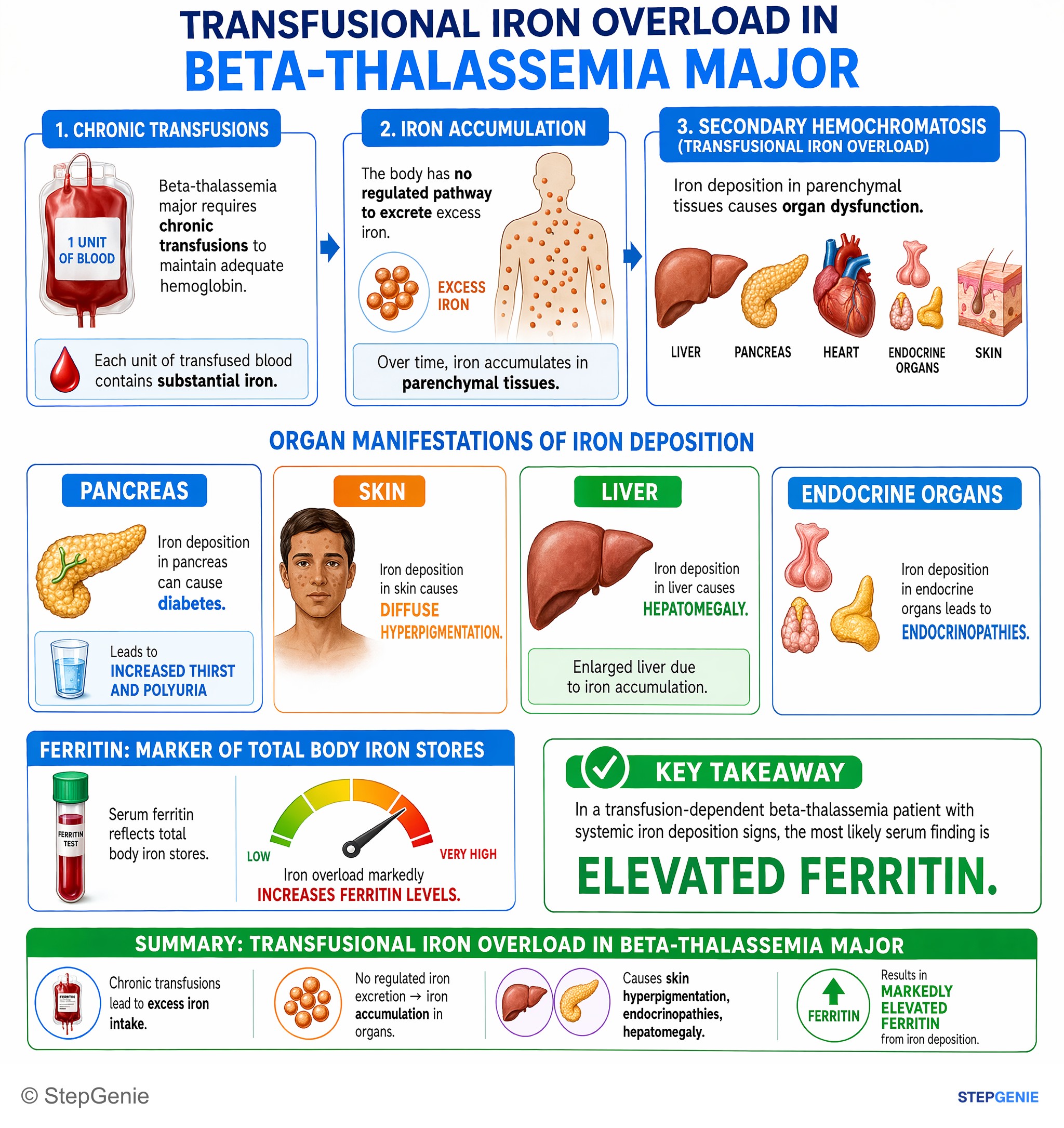 Diabetes mellitus — StepGenie USMLE Step 1 explanation infographic