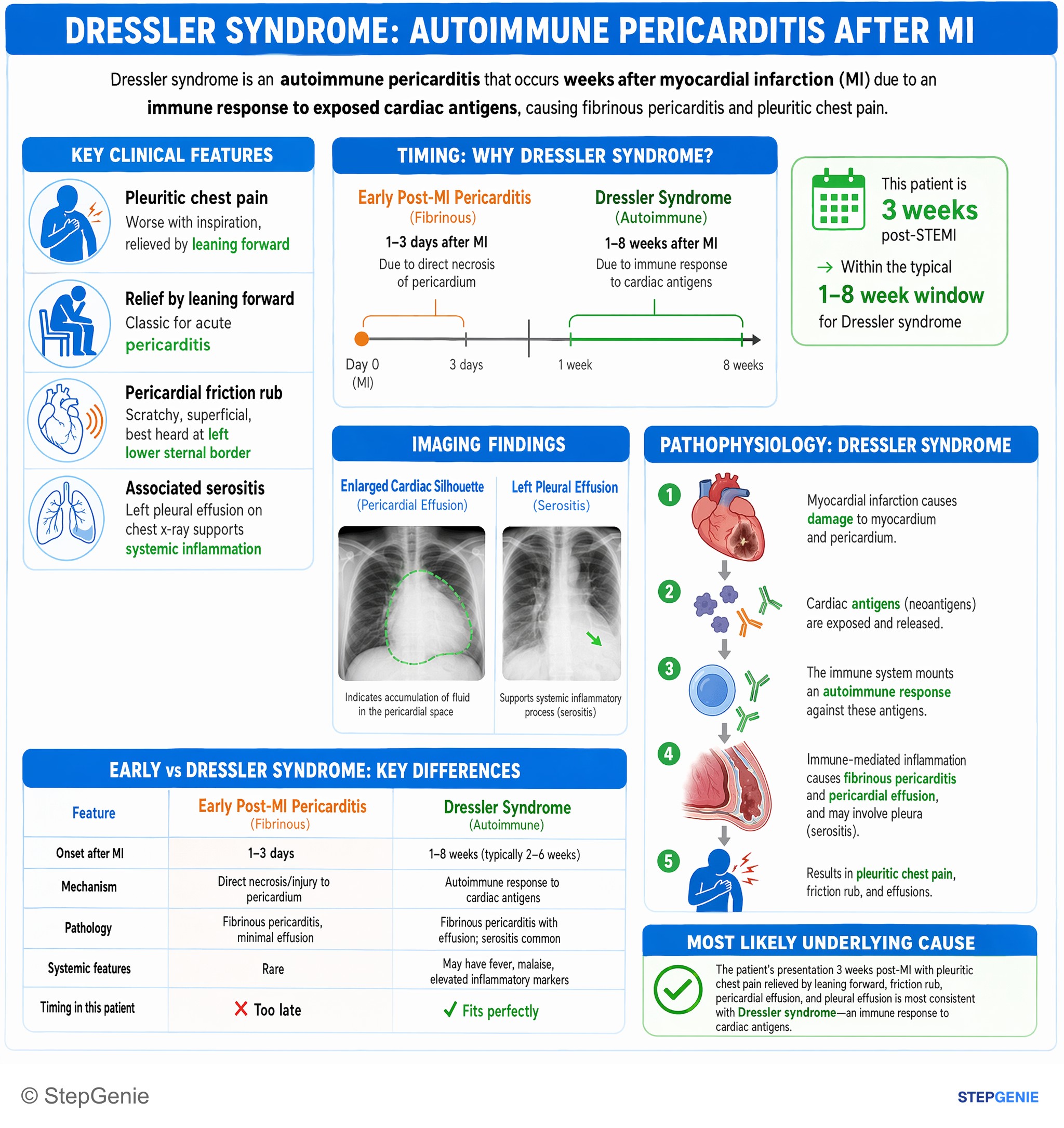 Myopericardial diseases — StepGenie USMLE Step 1 explanation infographic
