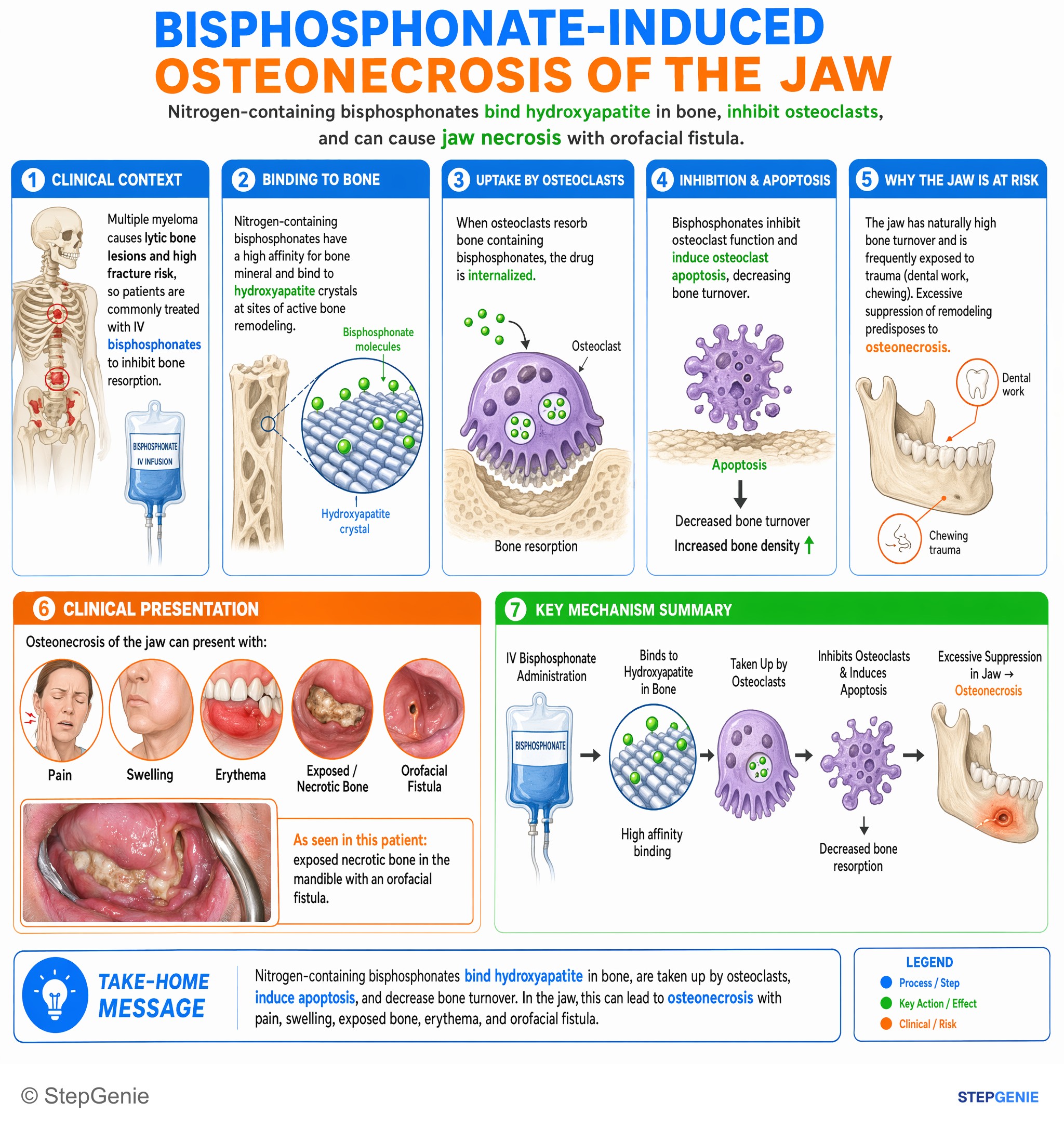 Metabolic bone disorders — StepGenie USMLE Step 1 explanation infographic