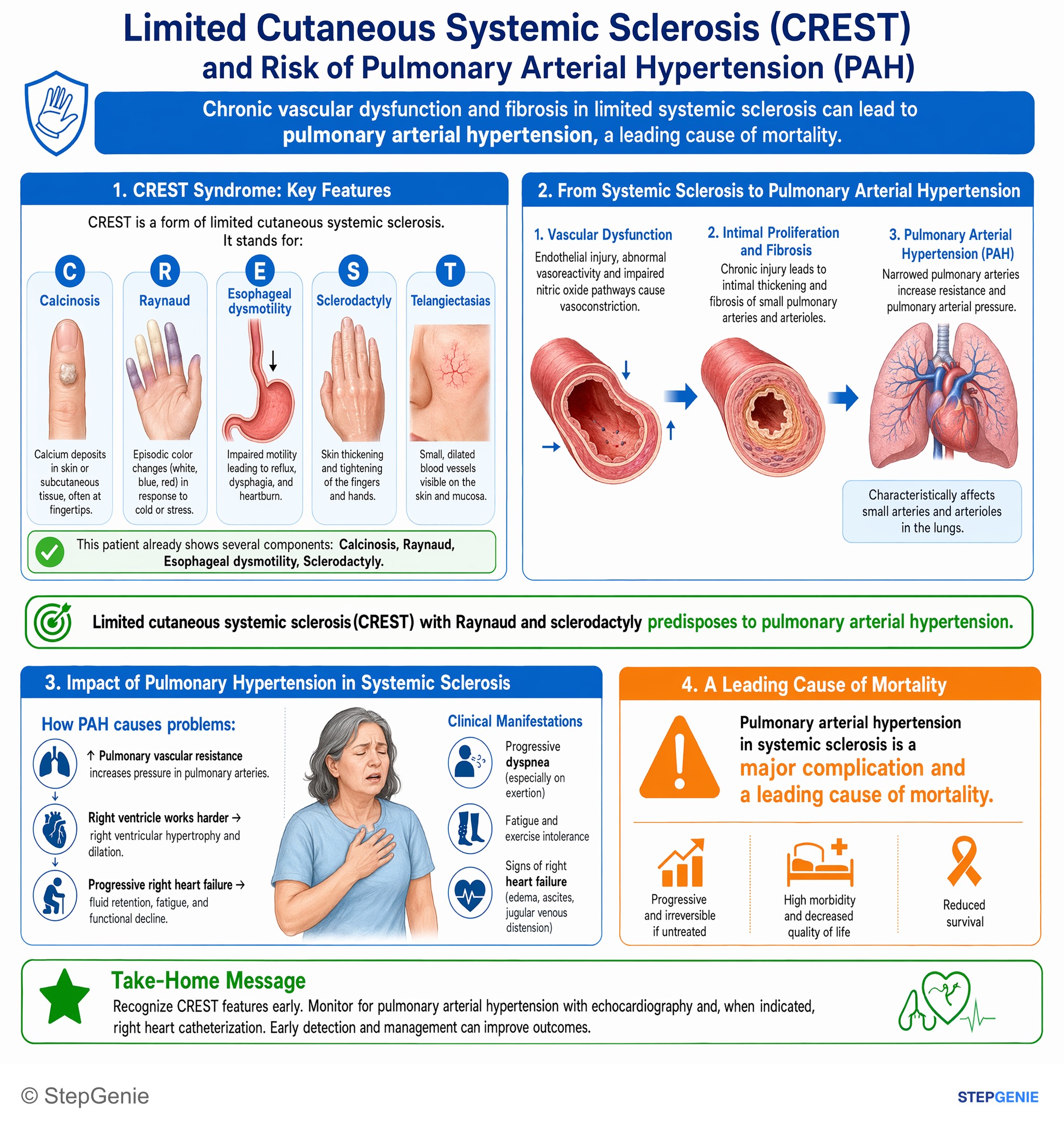 Step-by-step reasoning infographic: Limited cutaneous systemic sclerosis (CREST) with Raynaud and sclerodactyly predisposes to pulmonary arterial hypertension, a major cause of…
