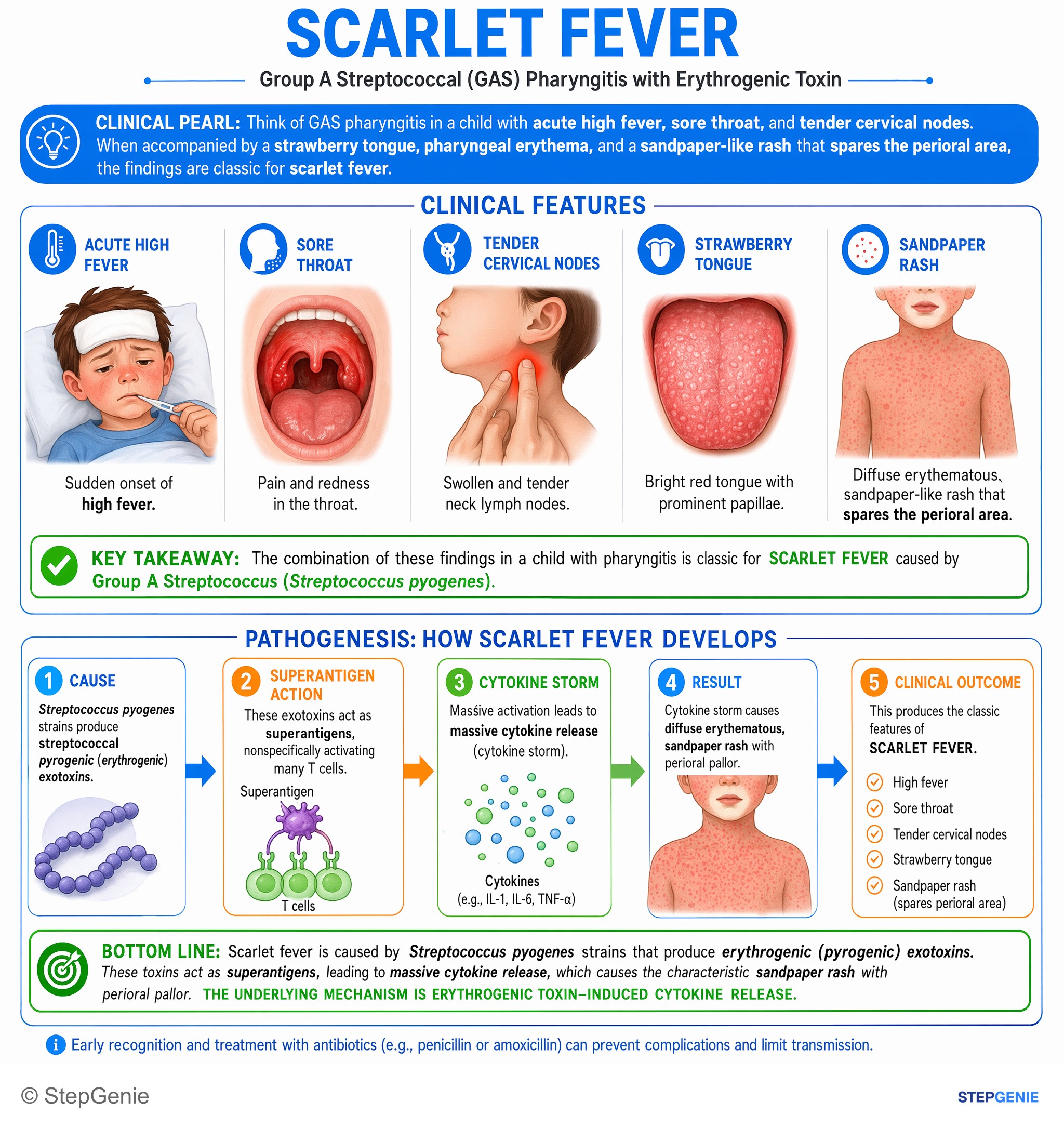 Bacterial infections — StepGenie USMLE Step 1 explanation infographic