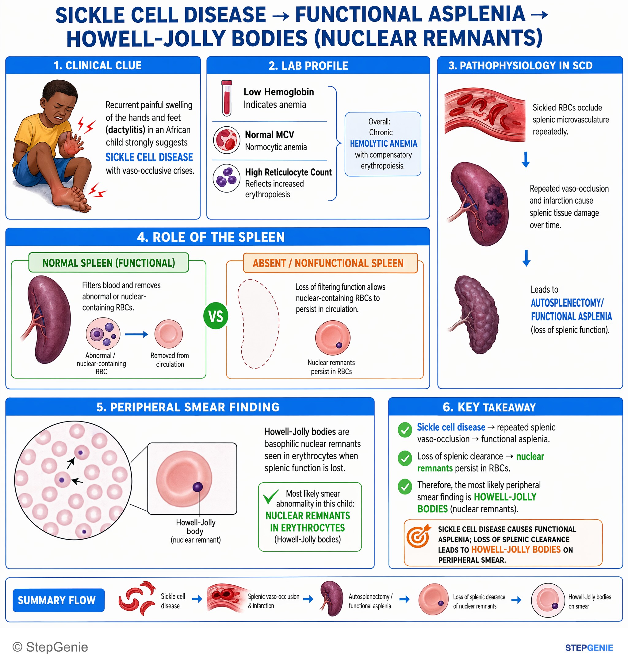 Disorders of RBCs and hemoglobin — StepGenie USMLE Step 1 explanation infographic