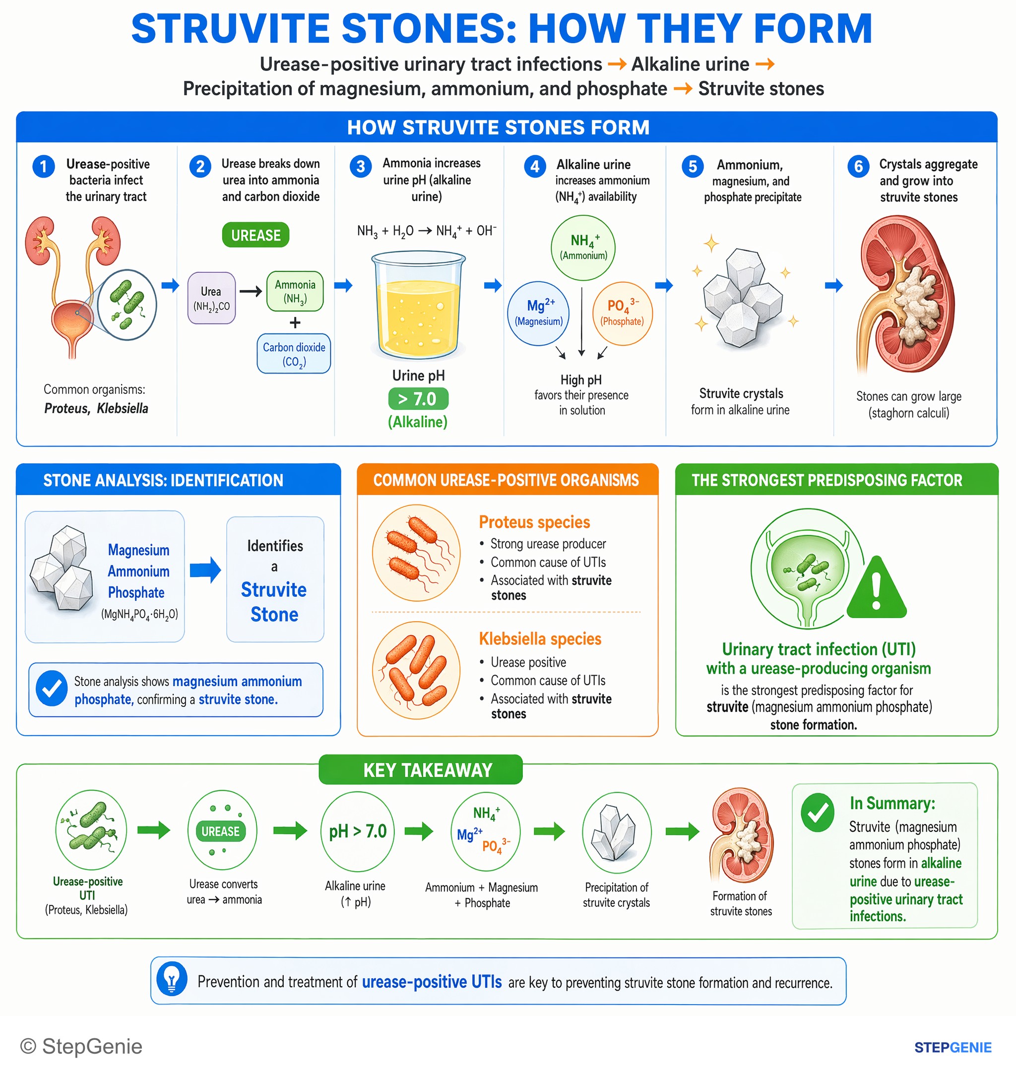 Nephrolithiasis and urinary tract obstruction — StepGenie USMLE Step 1 explanation infographic