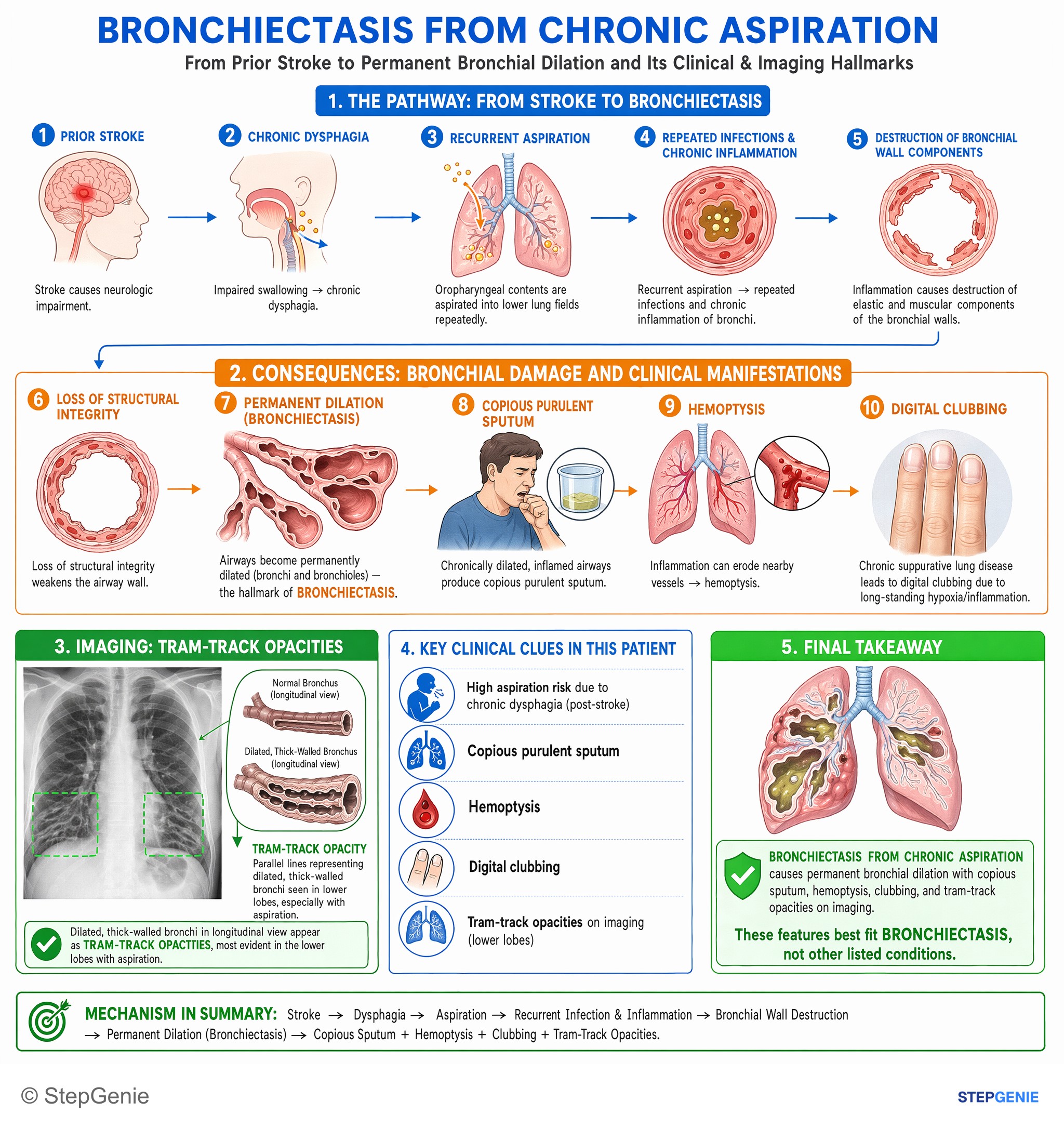 Obstructive and restrictive lung disease — StepGenie USMLE Step 2 explanation infographic