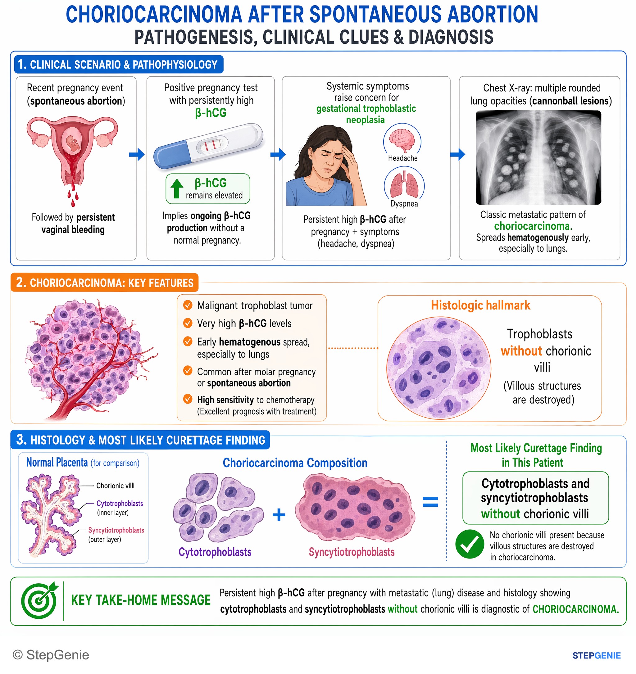 Gynecologic tumors / malignancy — StepGenie USMLE Step 1 explanation infographic