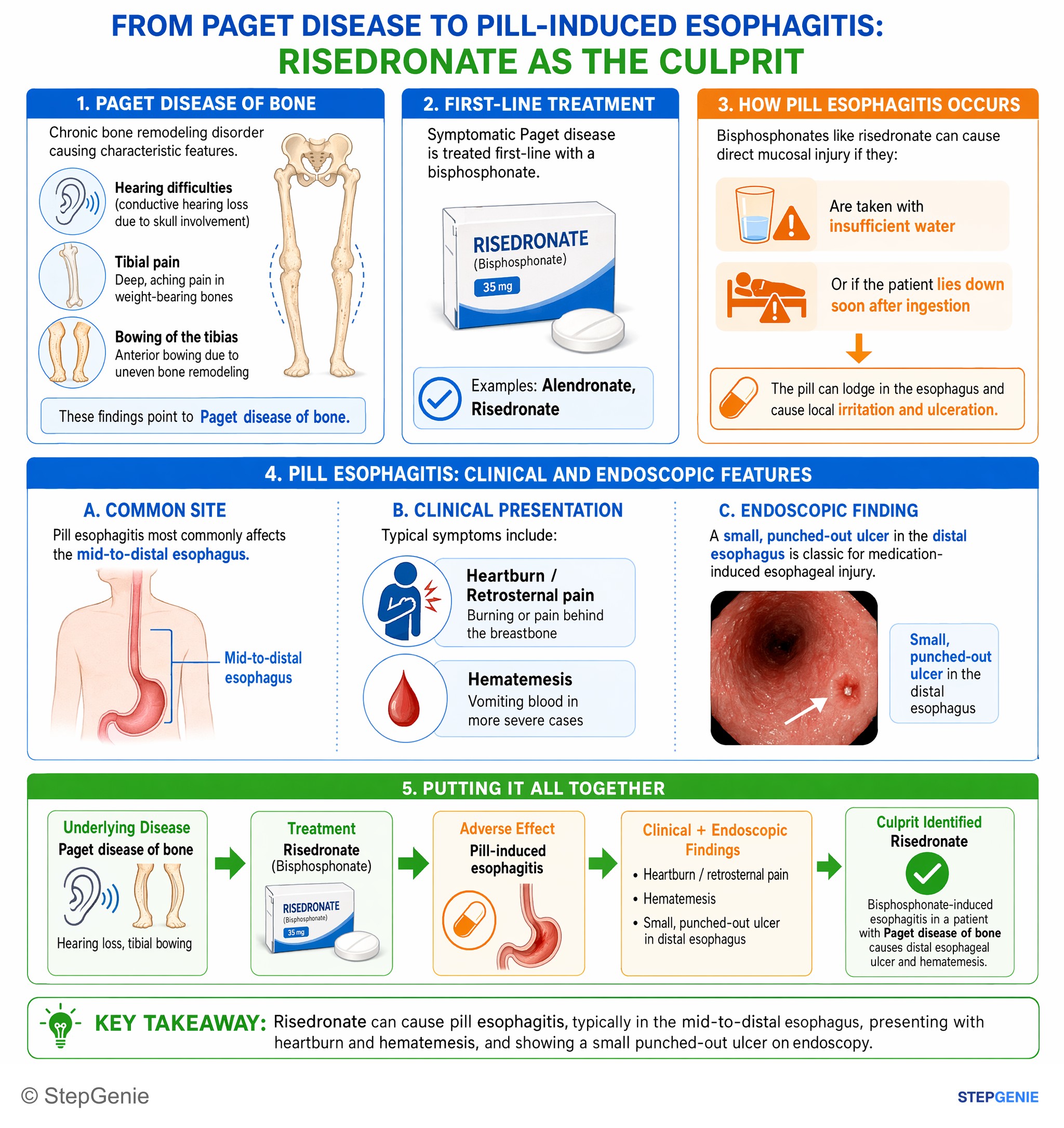 Gastroesophageal disorders — StepGenie USMLE Step 1 explanation infographic