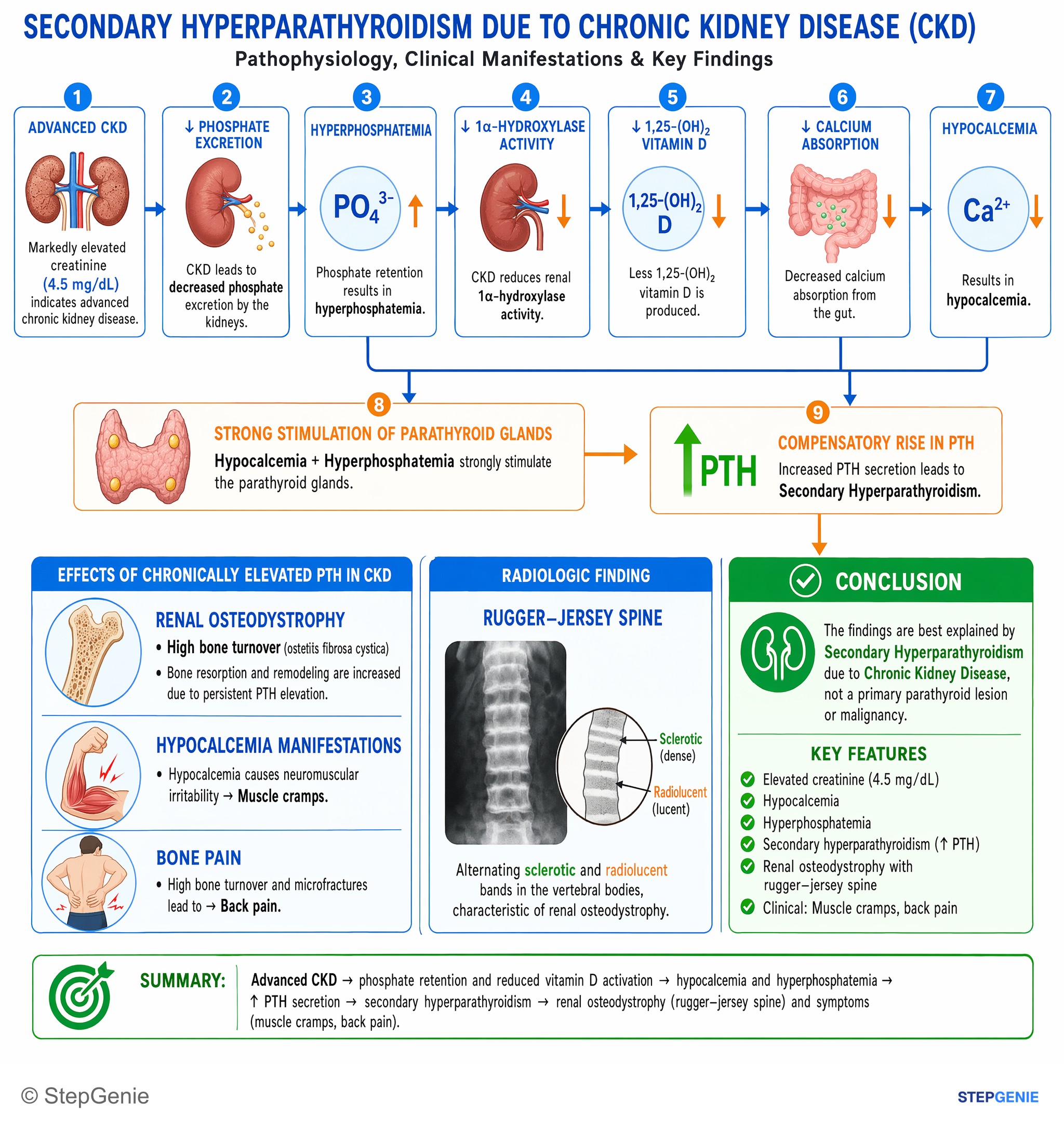Chronic kidney disease — StepGenie USMLE Step 1 explanation infographic