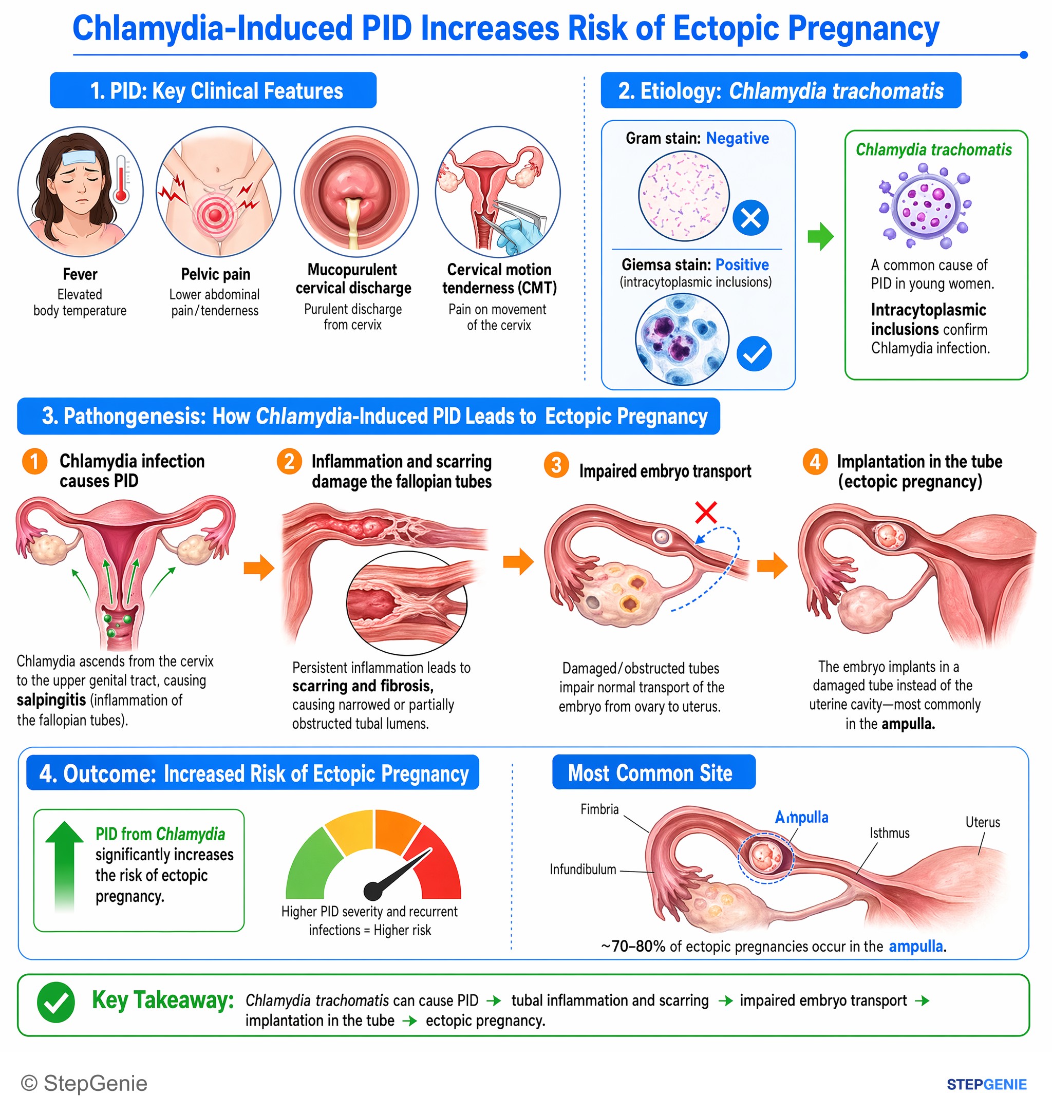 Gynecologic infections — StepGenie USMLE Step 1 explanation infographic