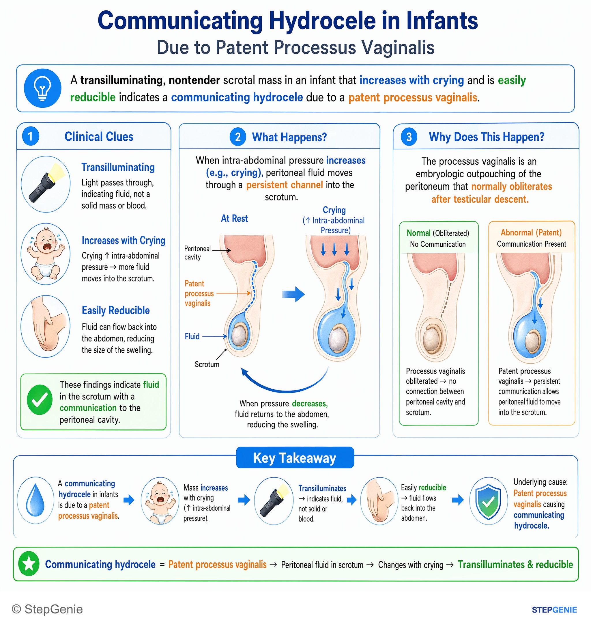 Hernias / Congenital anomalies — StepGenie USMLE Step 1 explanation infographic