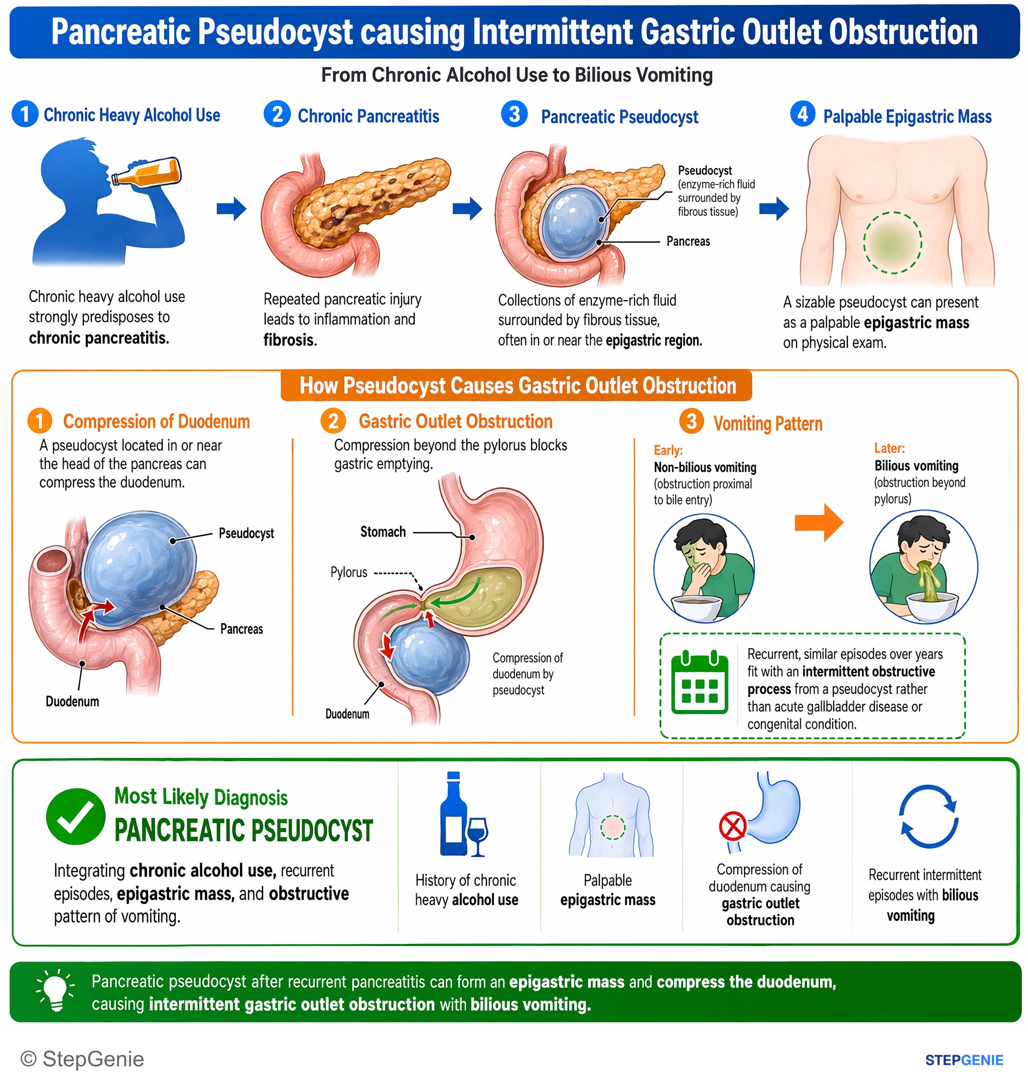 Pancreatic disorders — StepGenie USMLE Step 2 explanation infographic