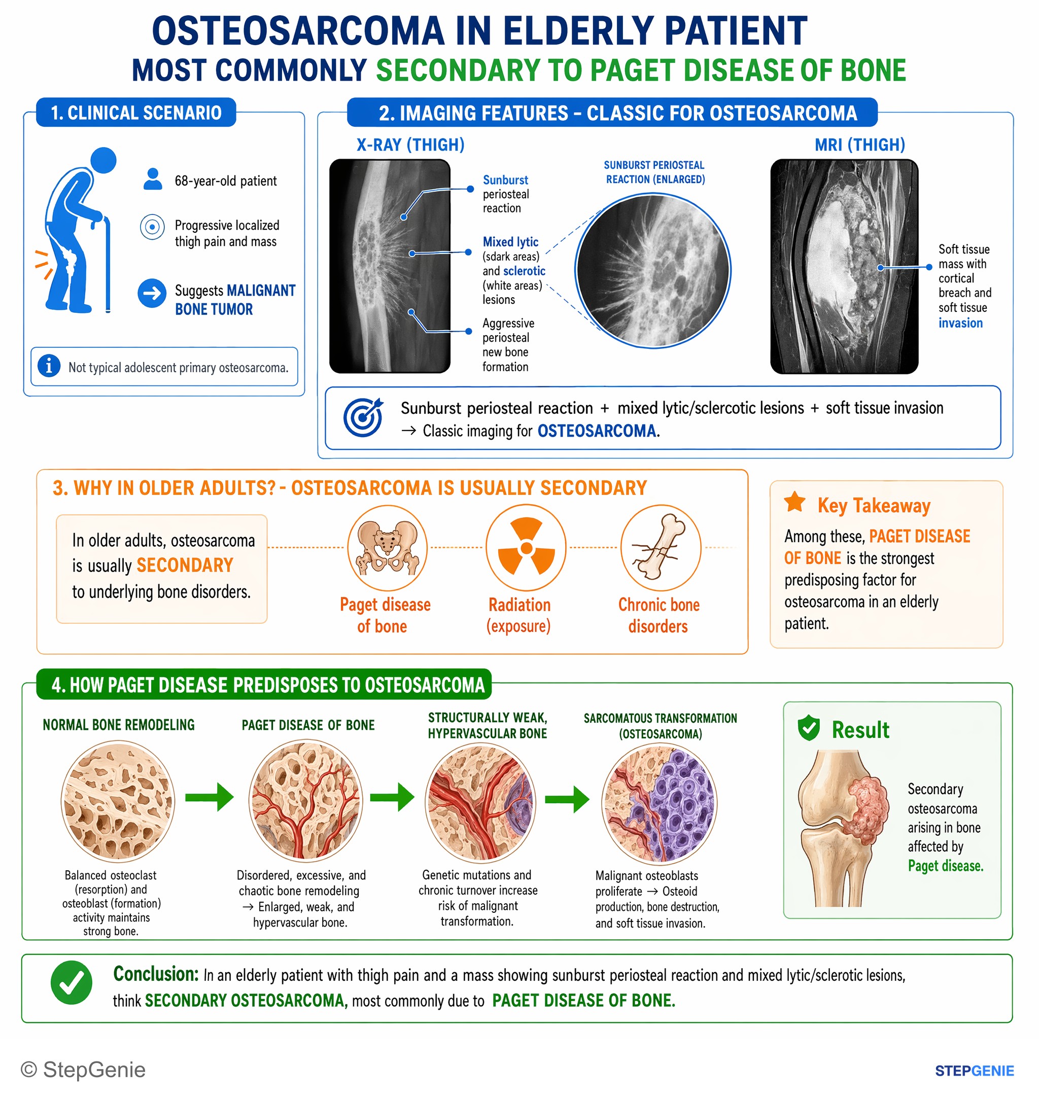 Bone tumors and tumor-like lesions — StepGenie USMLE Step 1 explanation infographic