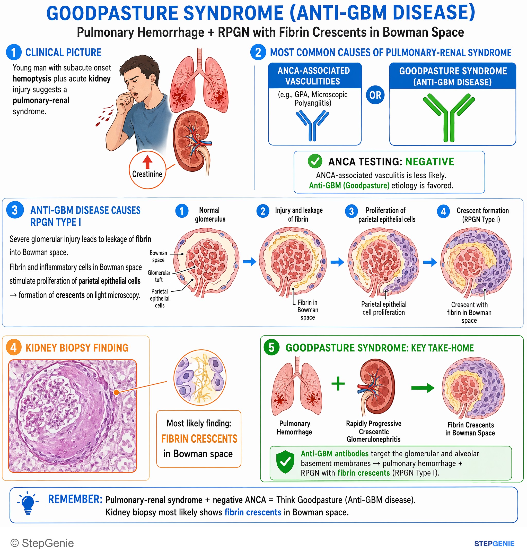 Glomerular diseases — StepGenie USMLE Step 1 explanation infographic