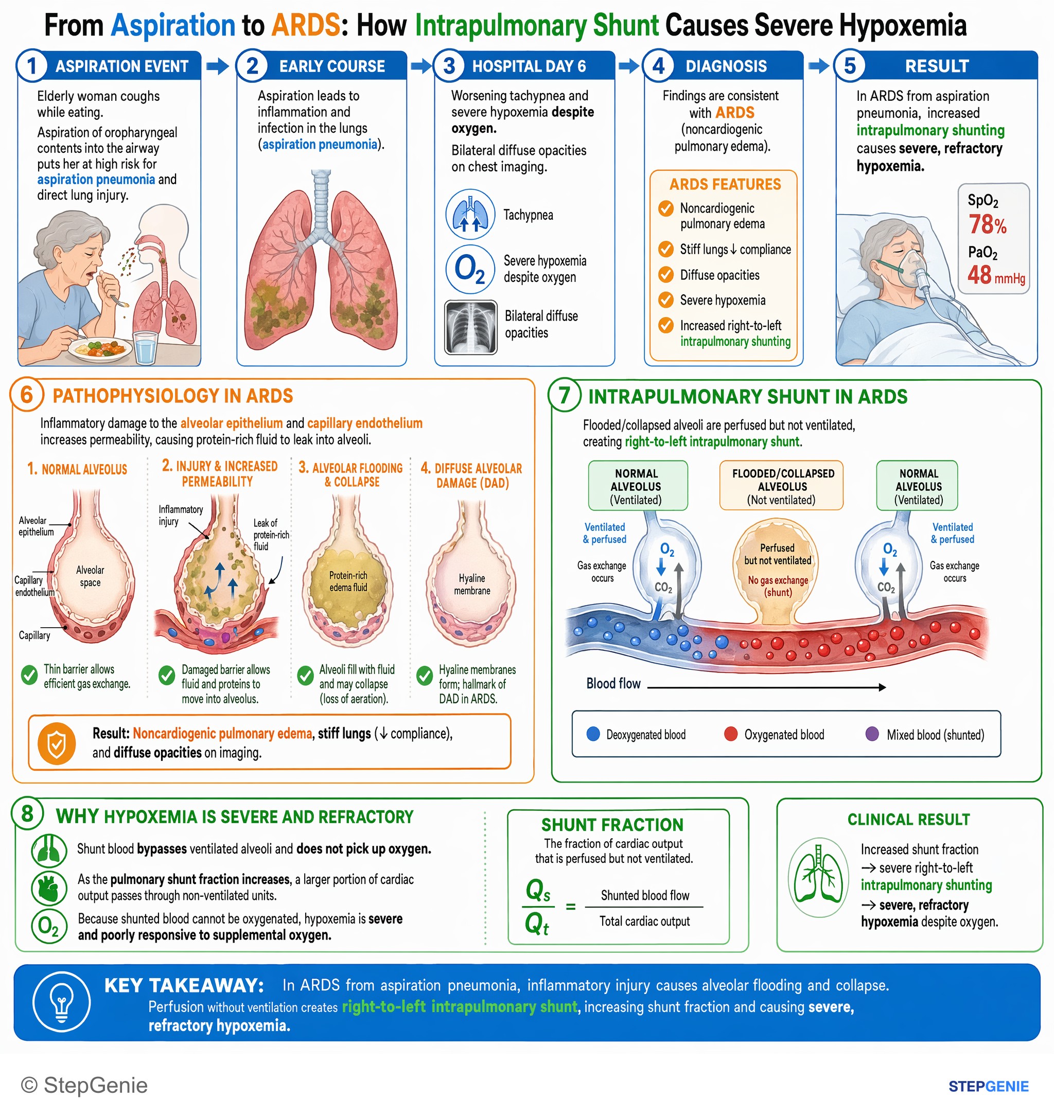 Critical care medicine — StepGenie USMLE Step 1 explanation infographic