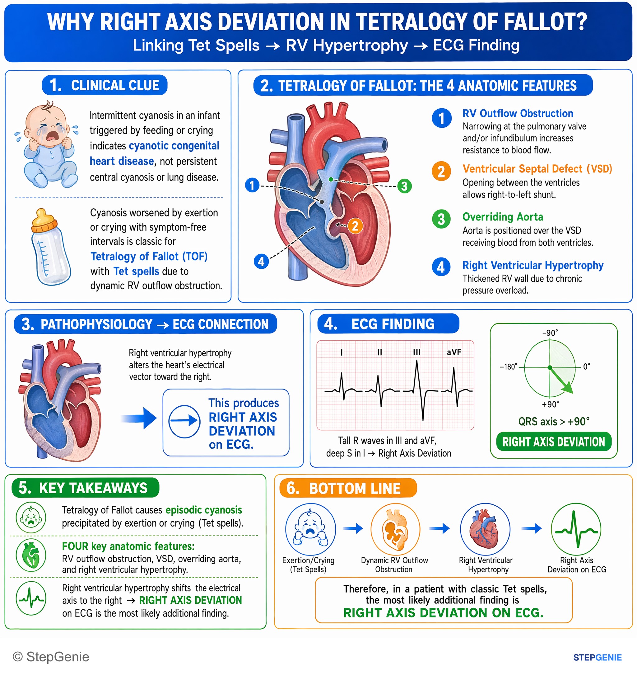 Congenital heart disease — StepGenie USMLE Step 2 explanation infographic