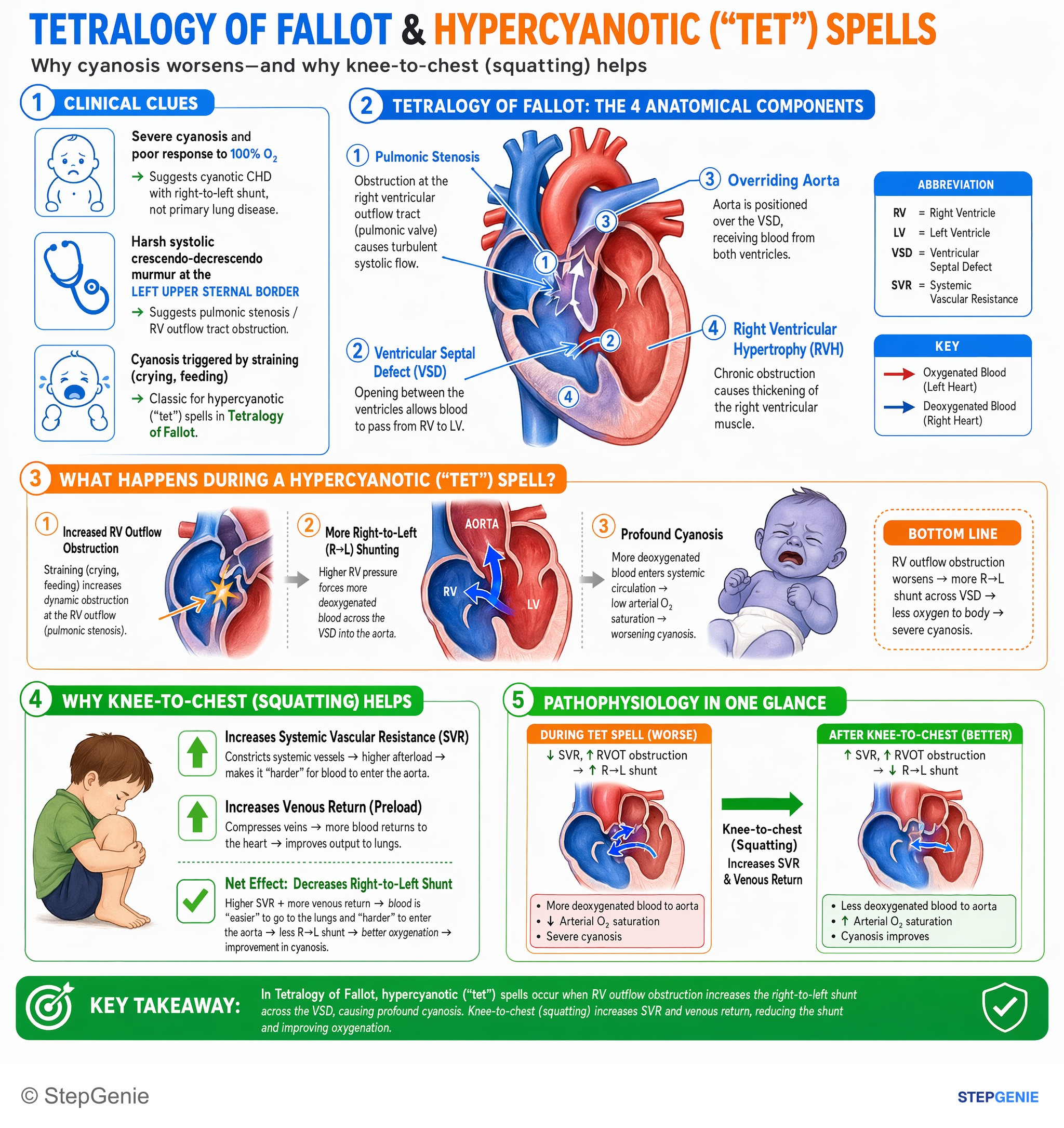 Congenital heart disease — StepGenie USMLE Step 2 explanation infographic