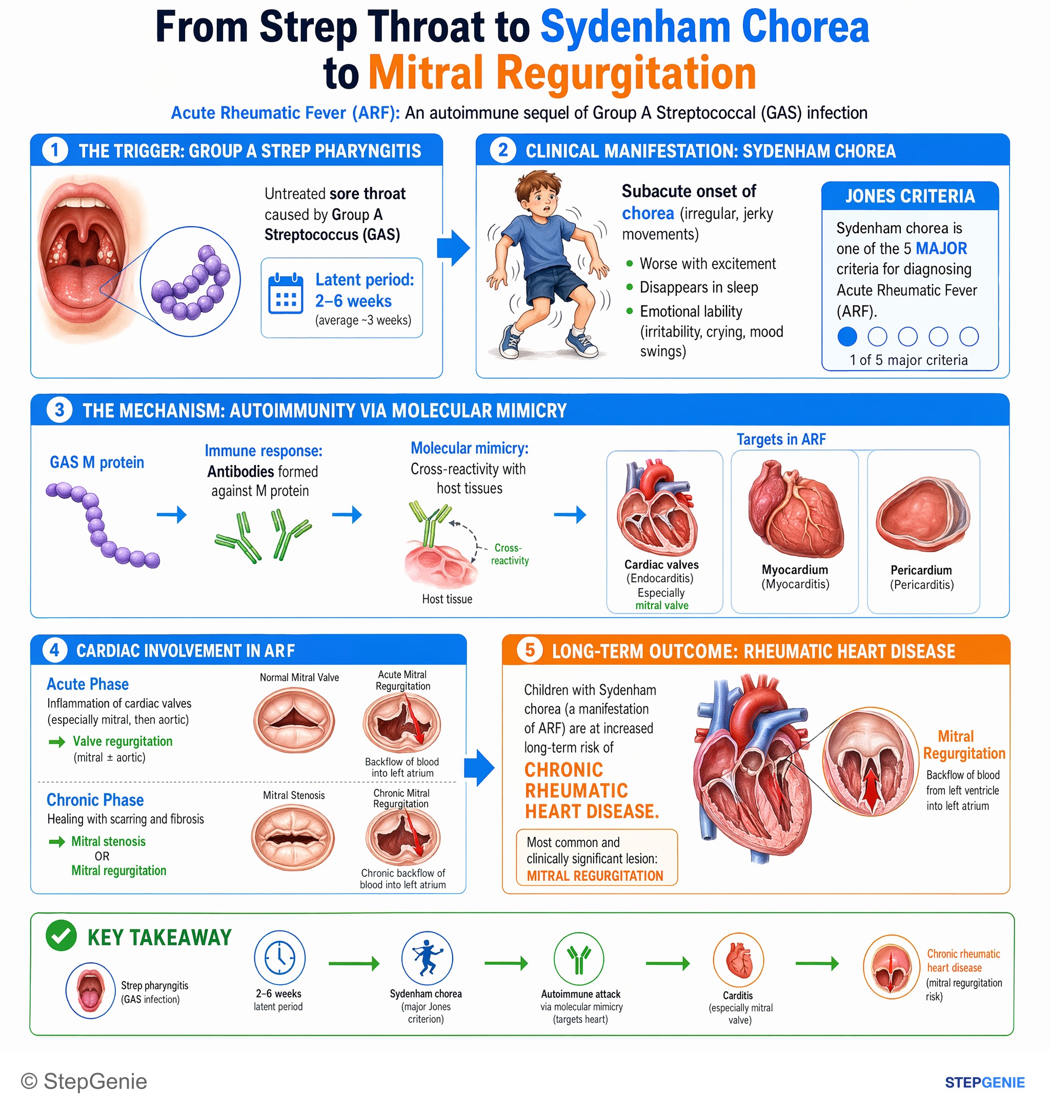 Valvular heart diseases — StepGenie USMLE Step 2 explanation infographic