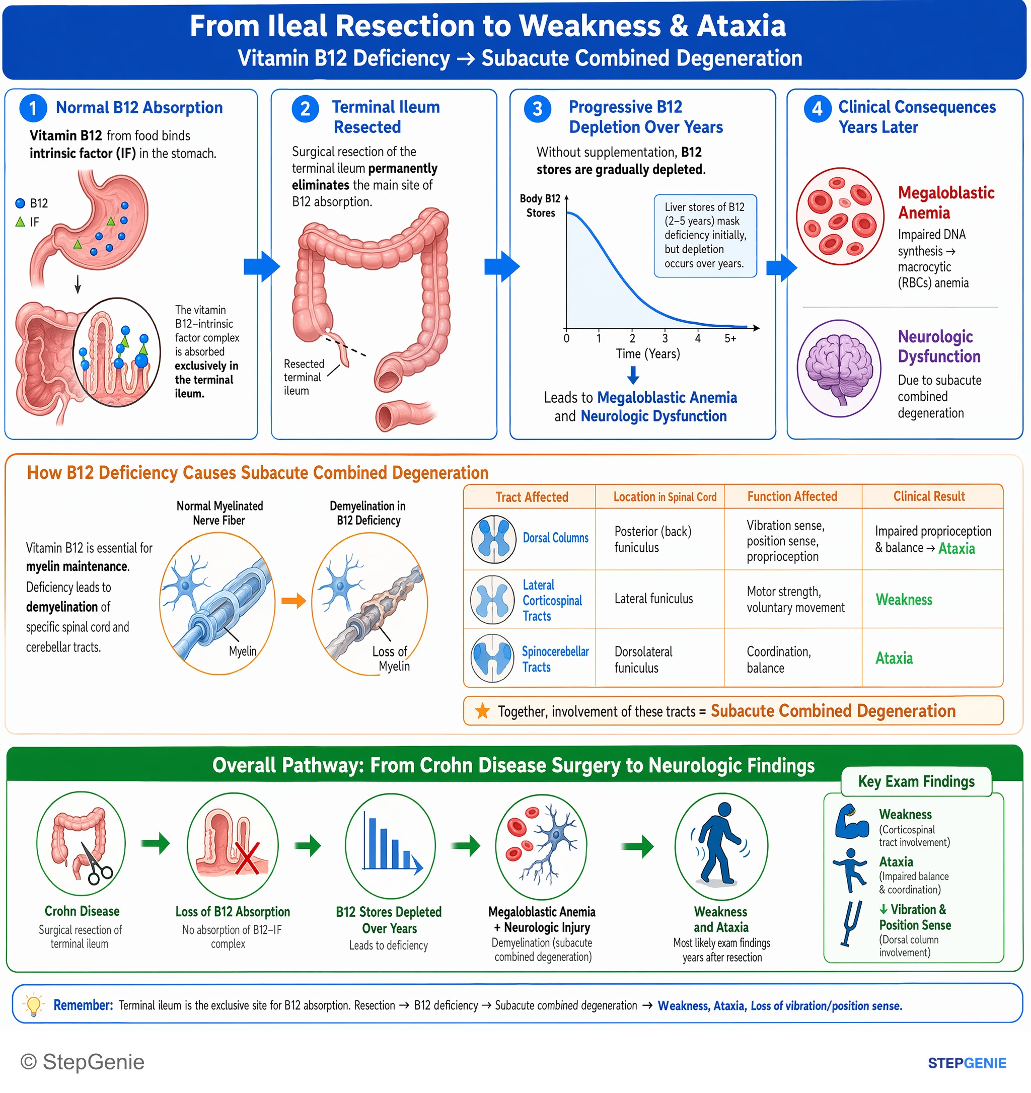 Intestinal and colorectal disorders — StepGenie USMLE Step 2 explanation infographic