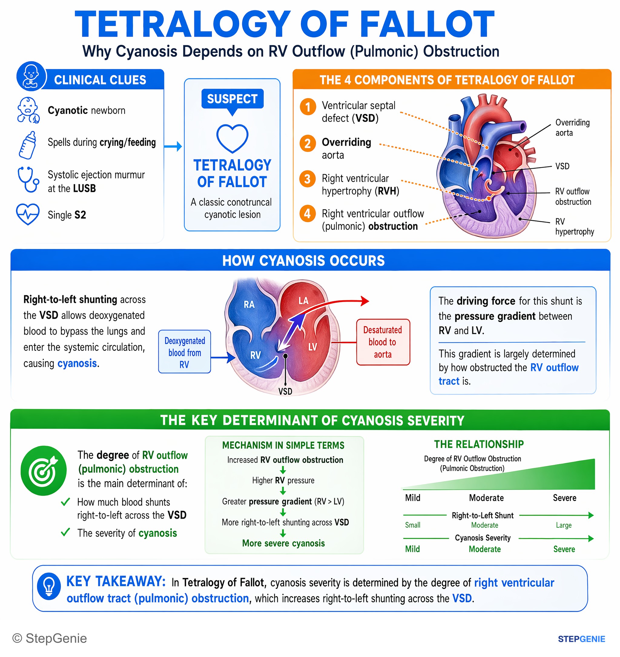 Congenital heart disease — StepGenie USMLE Step 1 explanation infographic