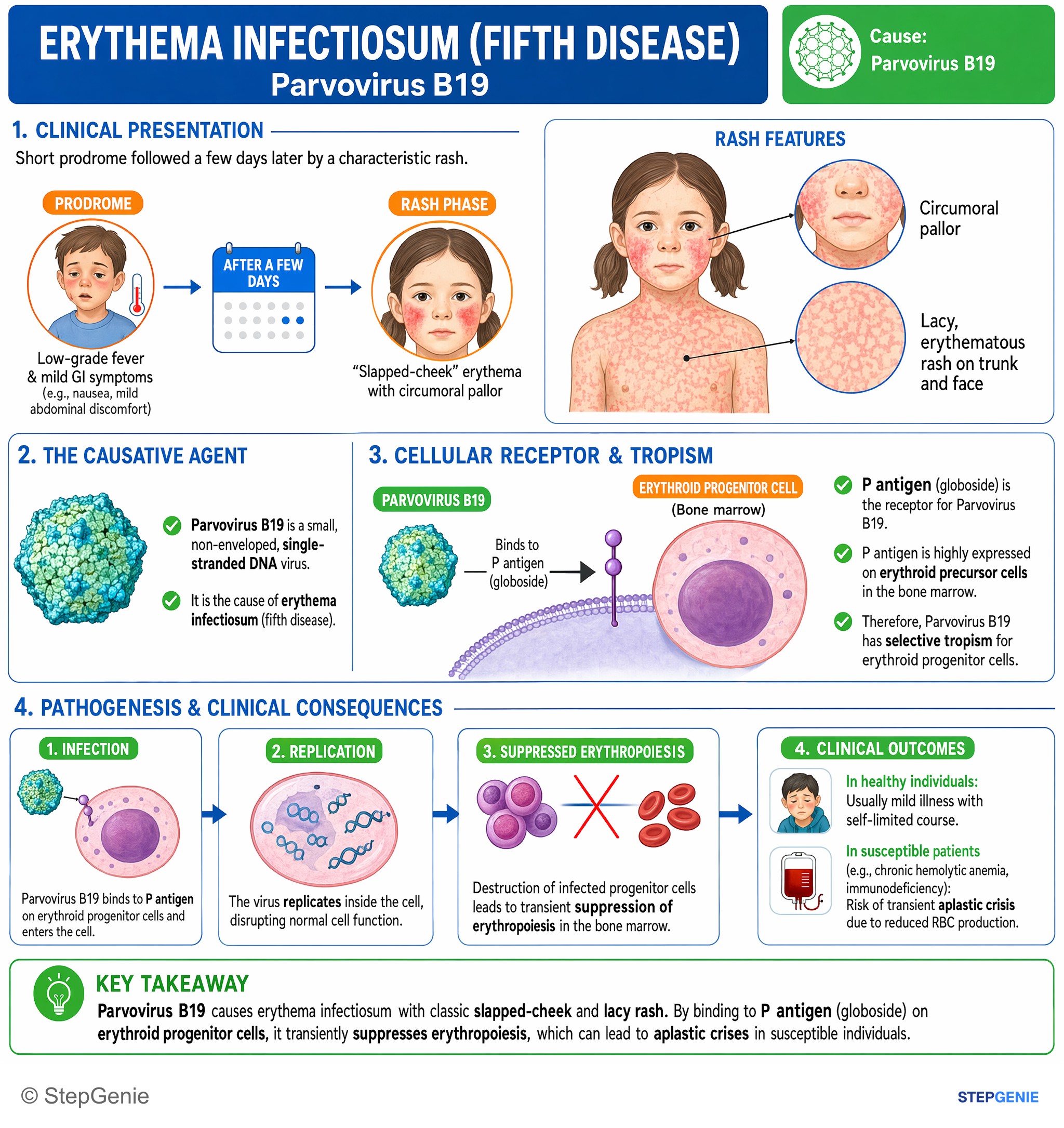 Viral infections — StepGenie USMLE Step 1 explanation infographic