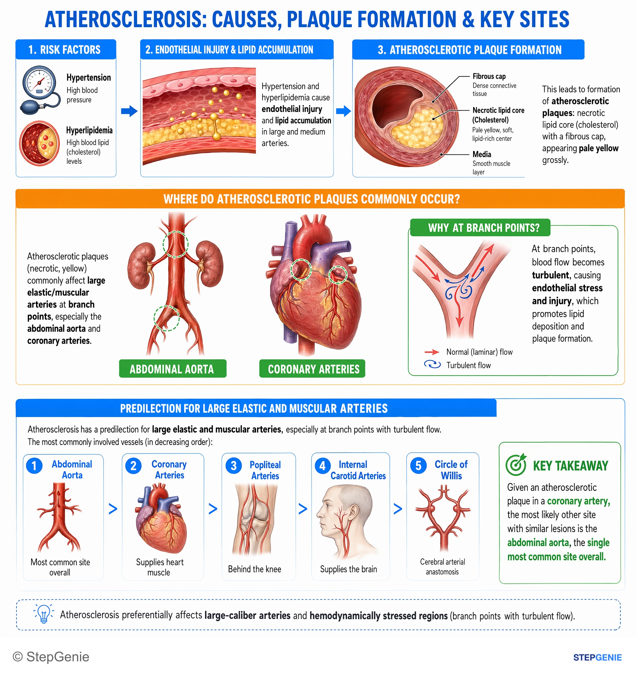 Coronary heart disease — StepGenie USMLE Step 1 explanation infographic
