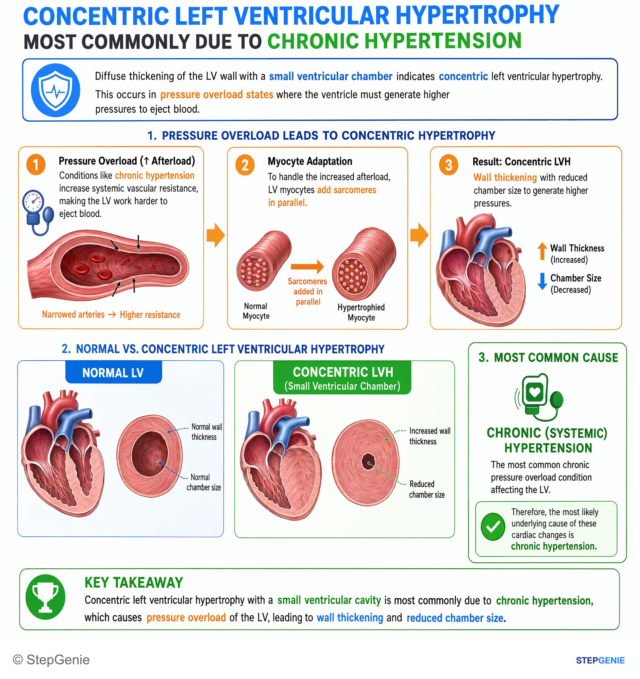 Hypertension — StepGenie USMLE Step 1 explanation infographic