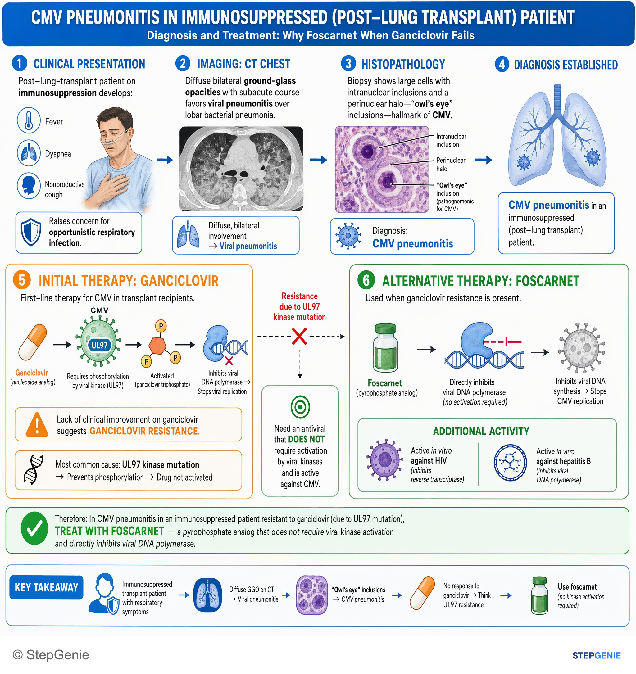 Antimicrobial drugs — StepGenie USMLE Step 1 explanation infographic