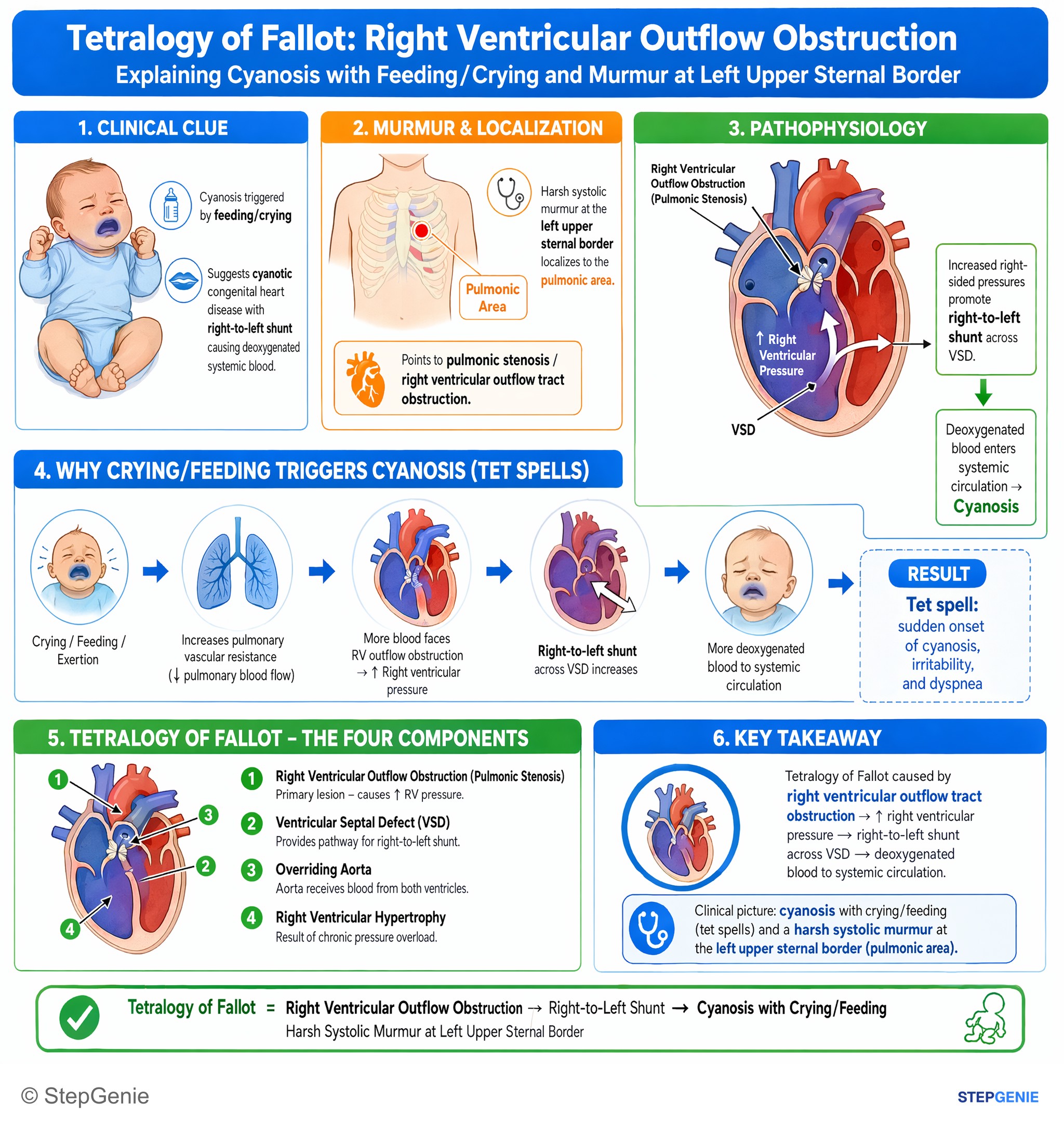 Congenital heart disease — StepGenie USMLE Step 1 explanation infographic
