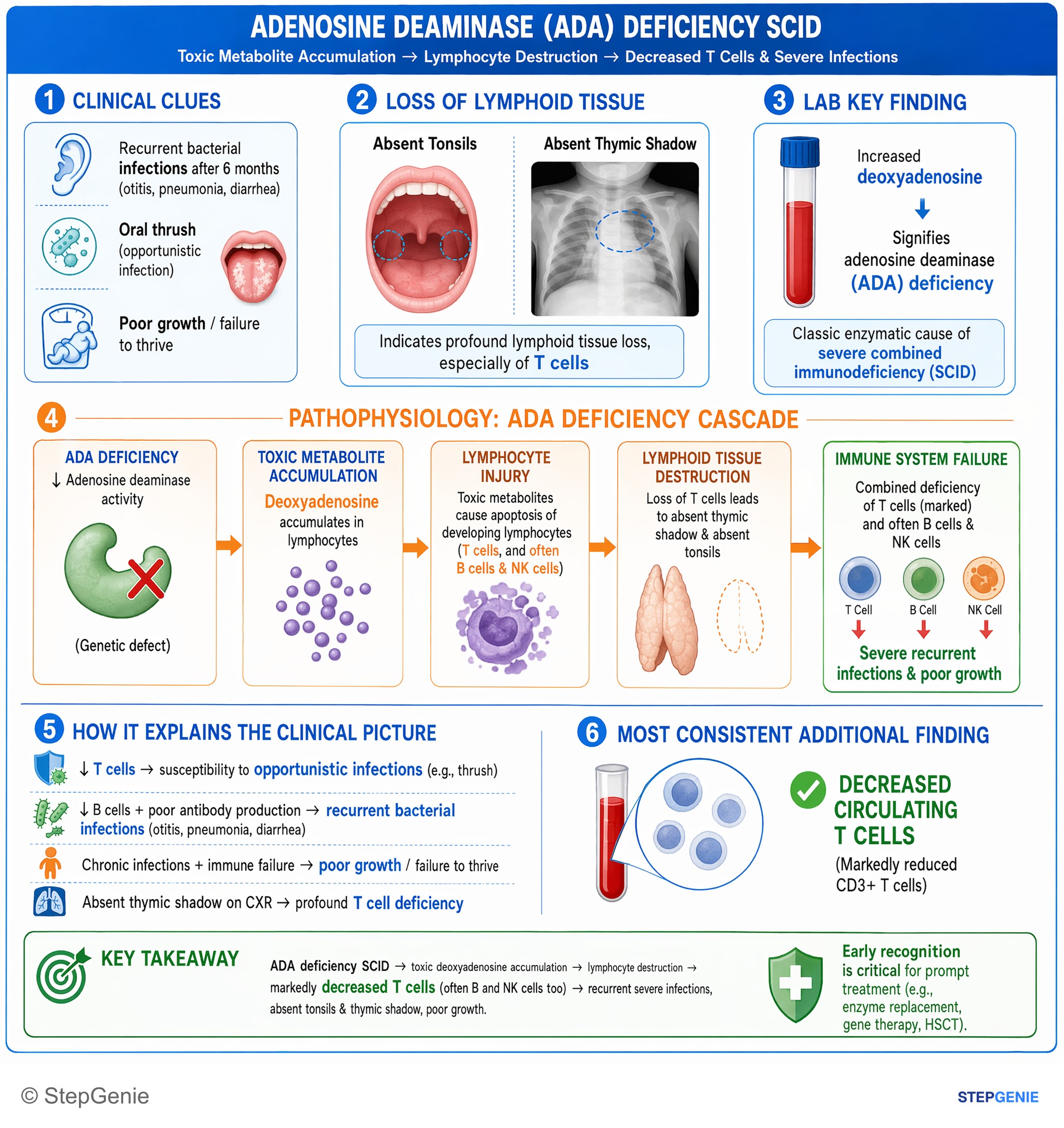 Immunodeficiency syndromes — StepGenie USMLE Step 1 explanation infographic