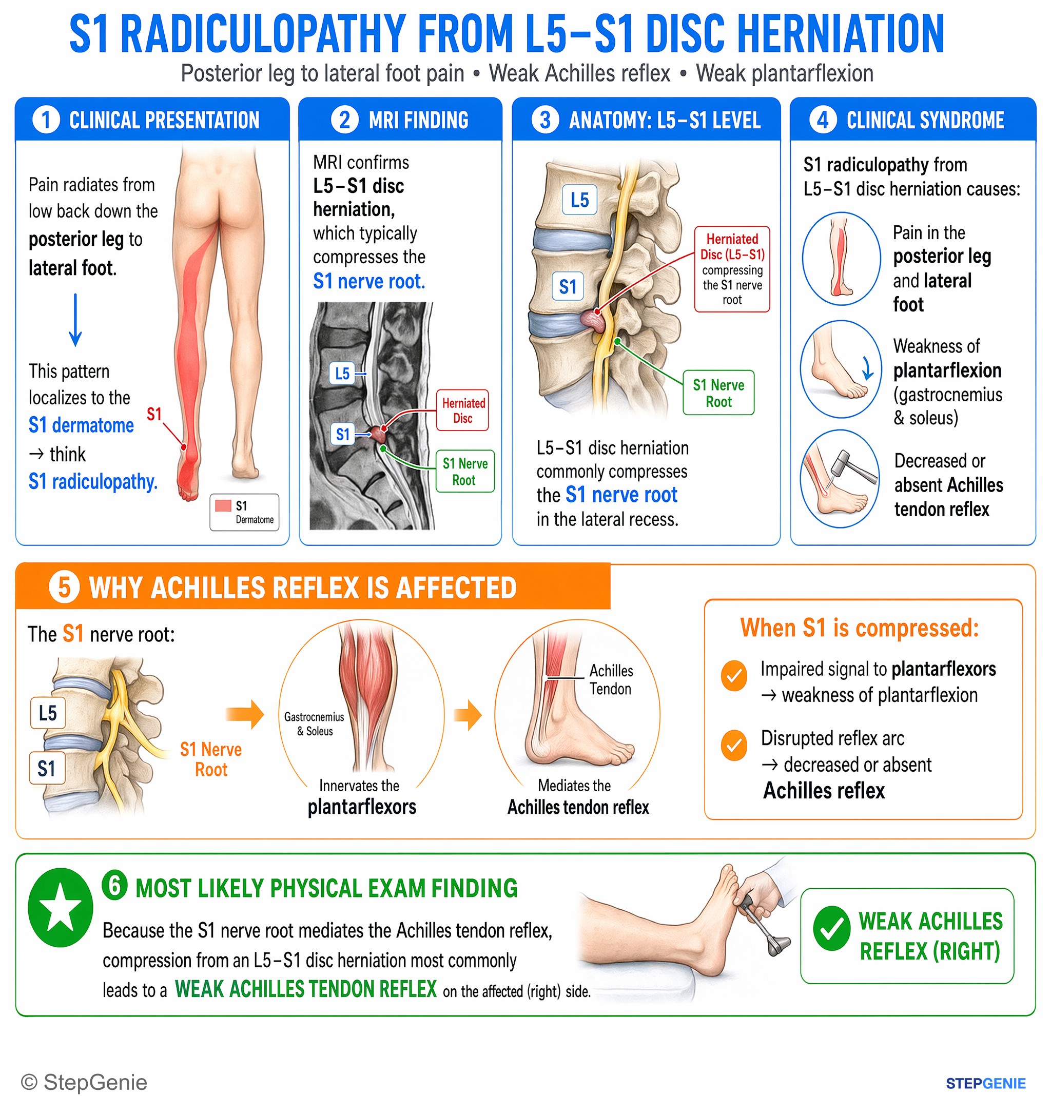 Spinal disorders and back pain — StepGenie USMLE Step 1 explanation infographic