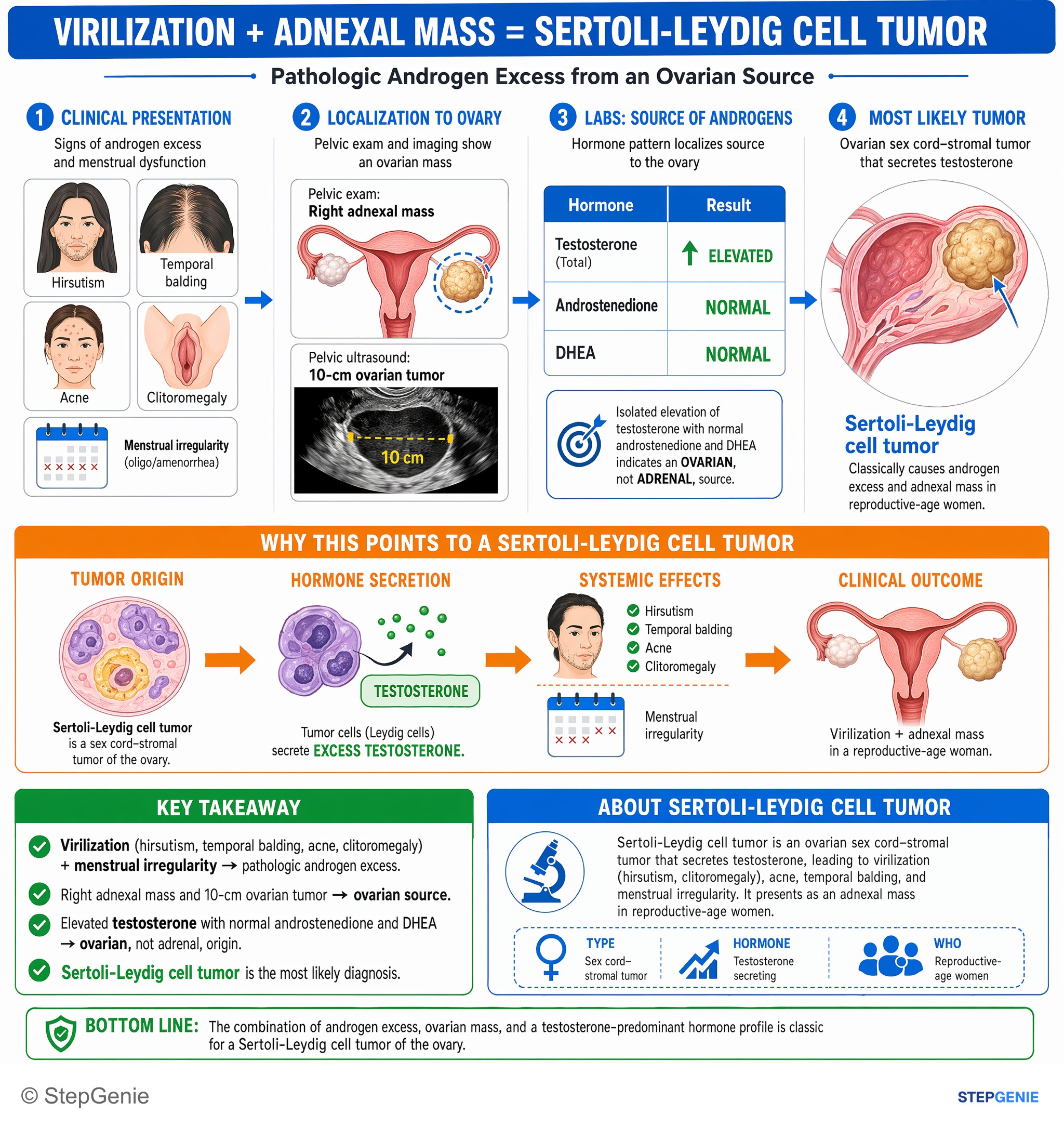 Step-by-step reasoning infographic: Sertoli-Leydig cell tumor is an ovarian sex cord–stromal tumor that secretes testosterone, causing virilization (hirsutism, clitoromegaly) and an…
