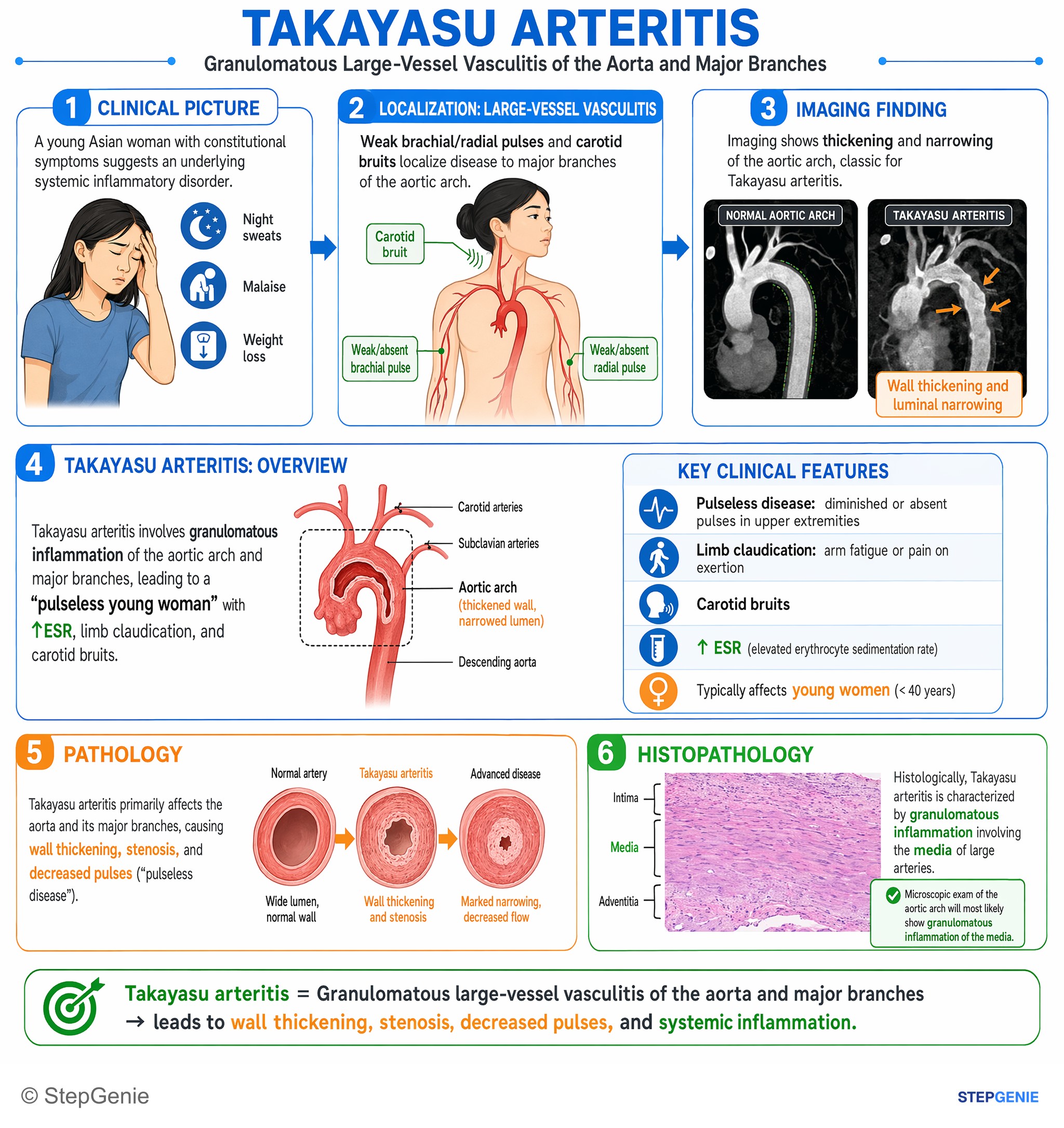 Vasculitis conditions (Vasculitides) — StepGenie USMLE Step 1 explanation infographic