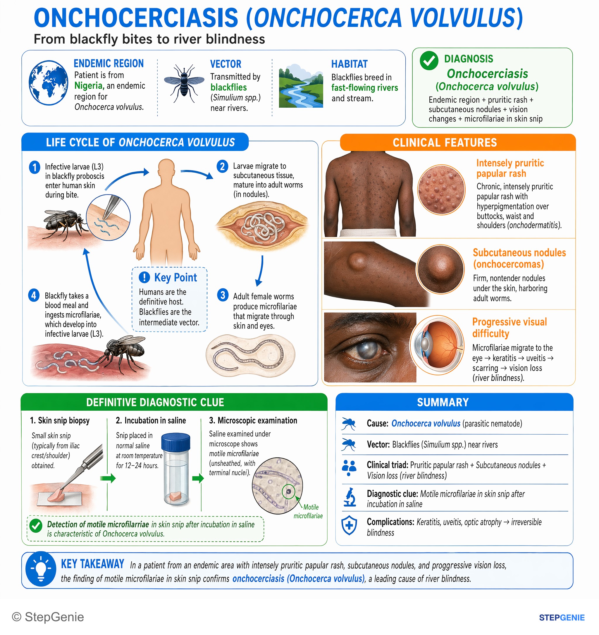 Step-by-step reasoning infographic: Onchocerciasis (Onchocerca volvulus) from blackfly bites → pruritic papular rash, subcutaneous nodules, microfilariae in skin snips, and progressive…