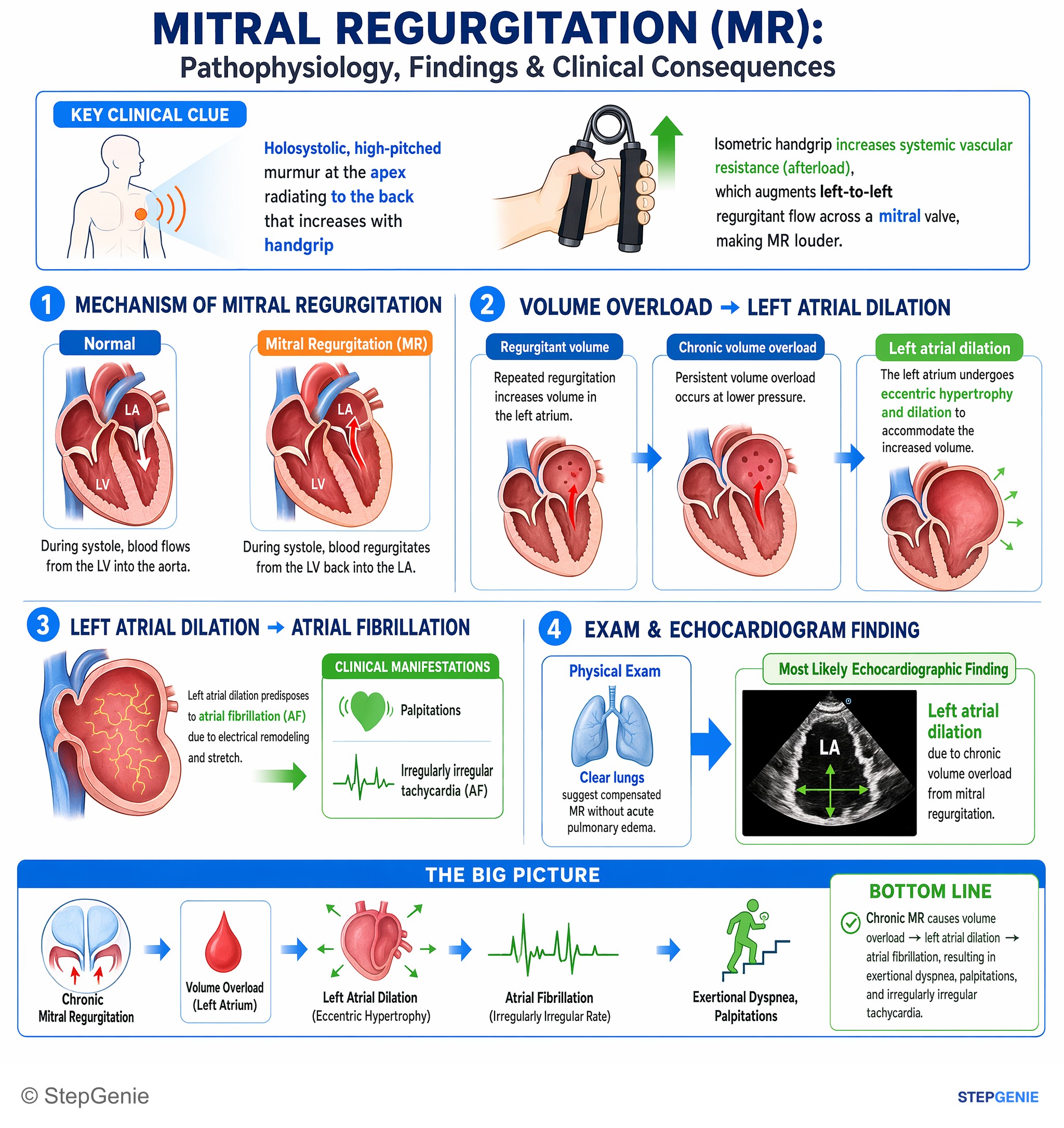 Valvular heart diseases — StepGenie USMLE Step 2 explanation infographic