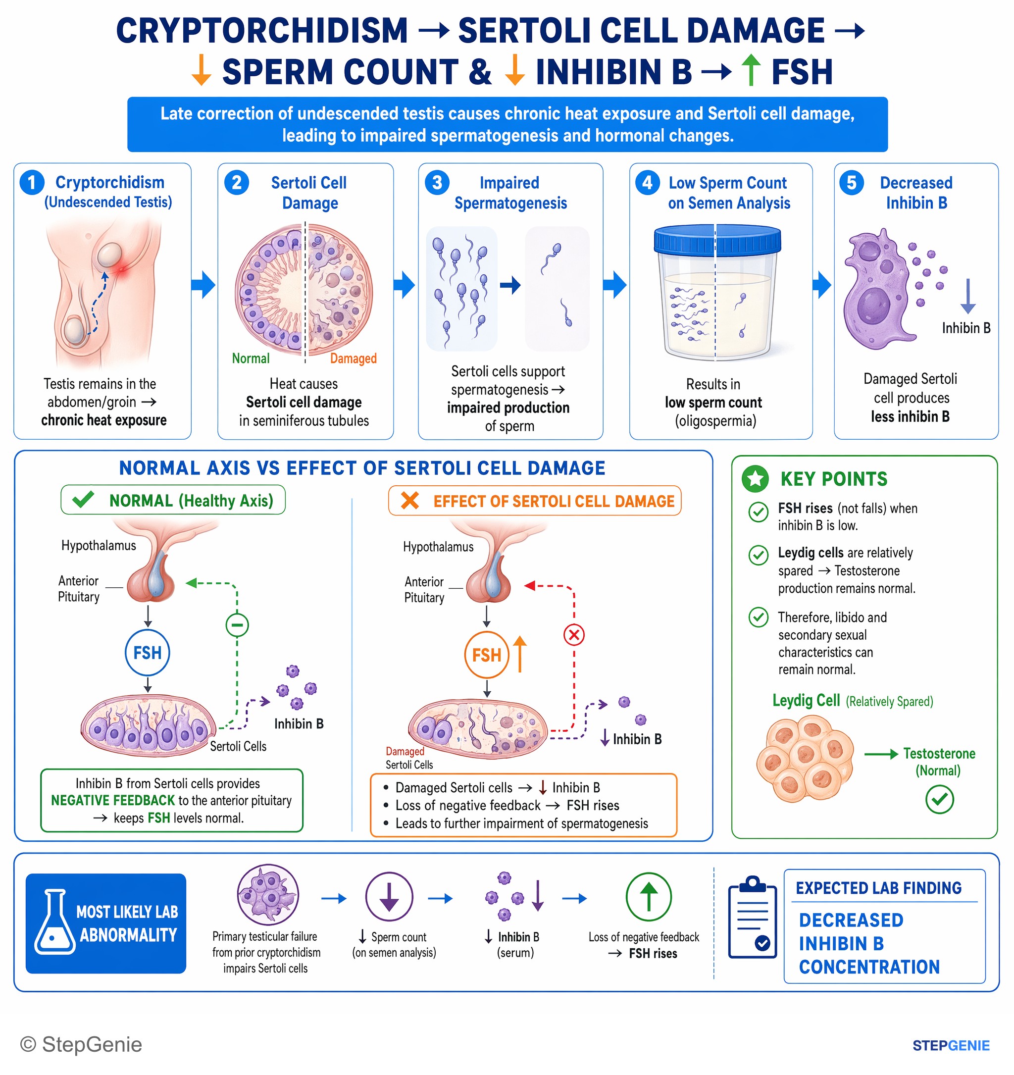 Disorders of the male reproductive system — StepGenie USMLE Step 1 explanation infographic