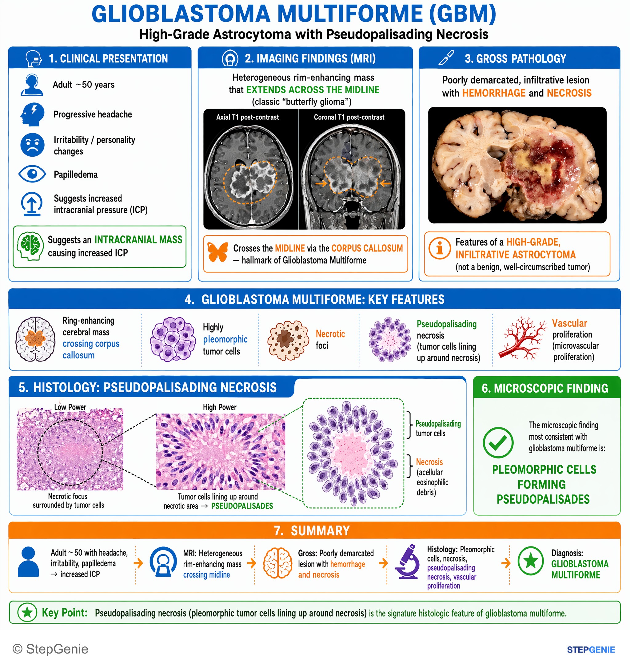 Tumors/Malignancy of the nervous system — StepGenie USMLE Step 1 explanation infographic