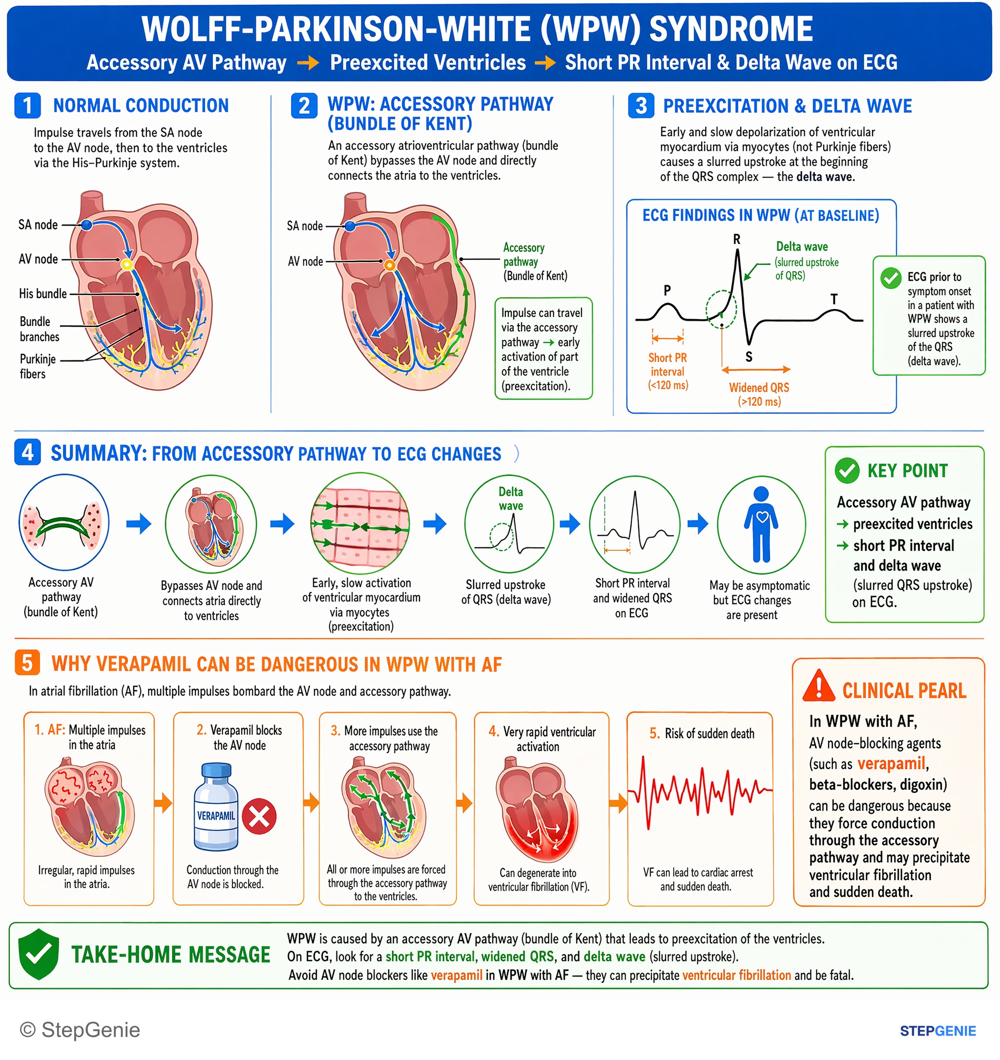 Cardiac arrhythmias — StepGenie USMLE Step 1 explanation infographic