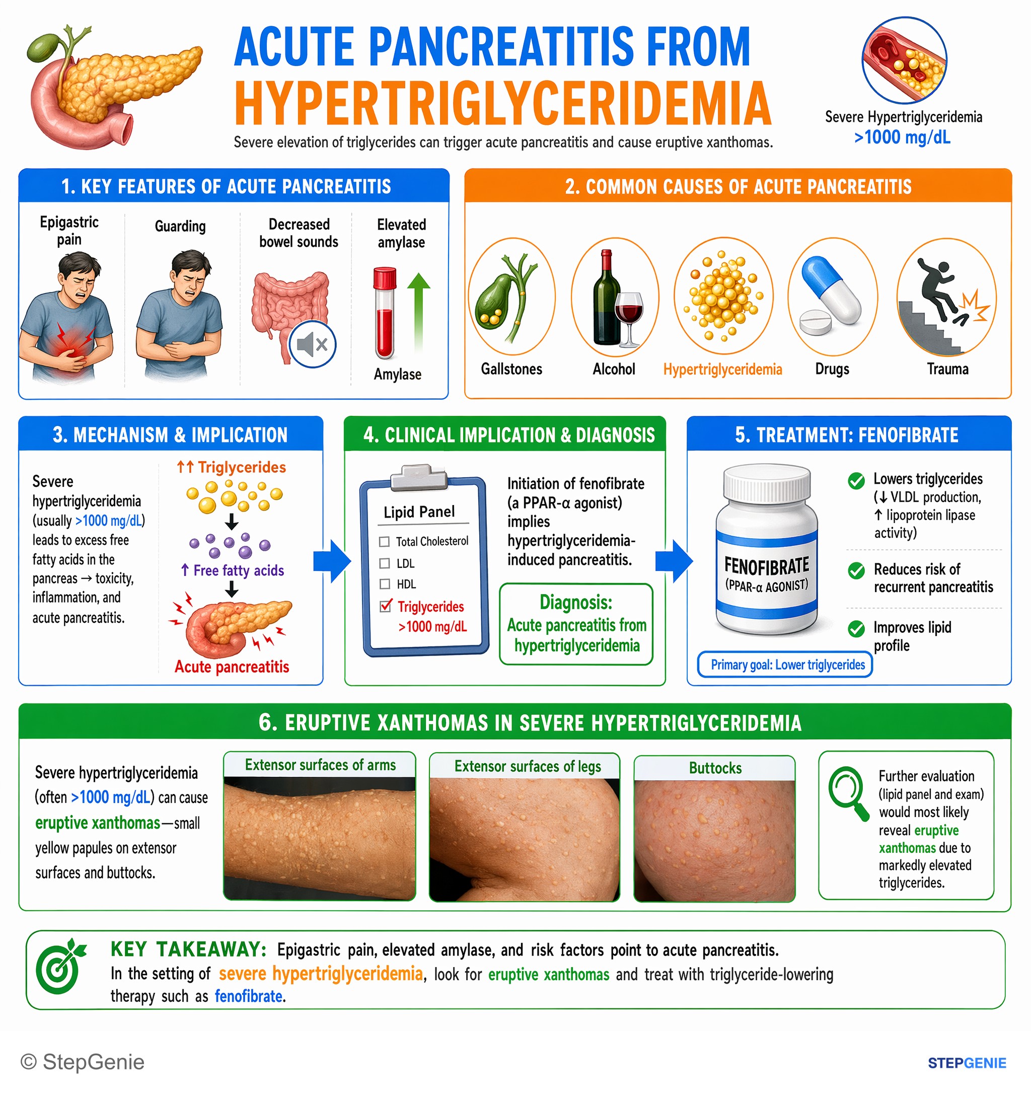 Pancreatic disorders — StepGenie USMLE Step 1 explanation infographic