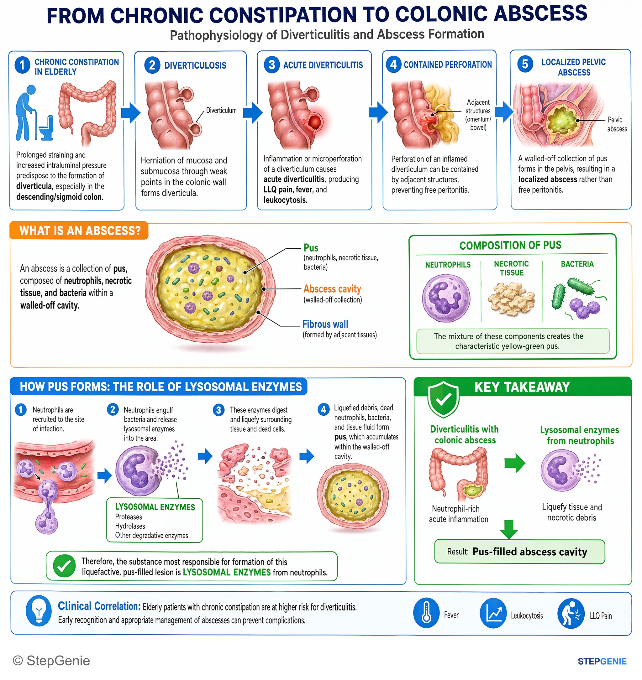 Intestinal and colorectal disorders — StepGenie USMLE Step 1 explanation infographic