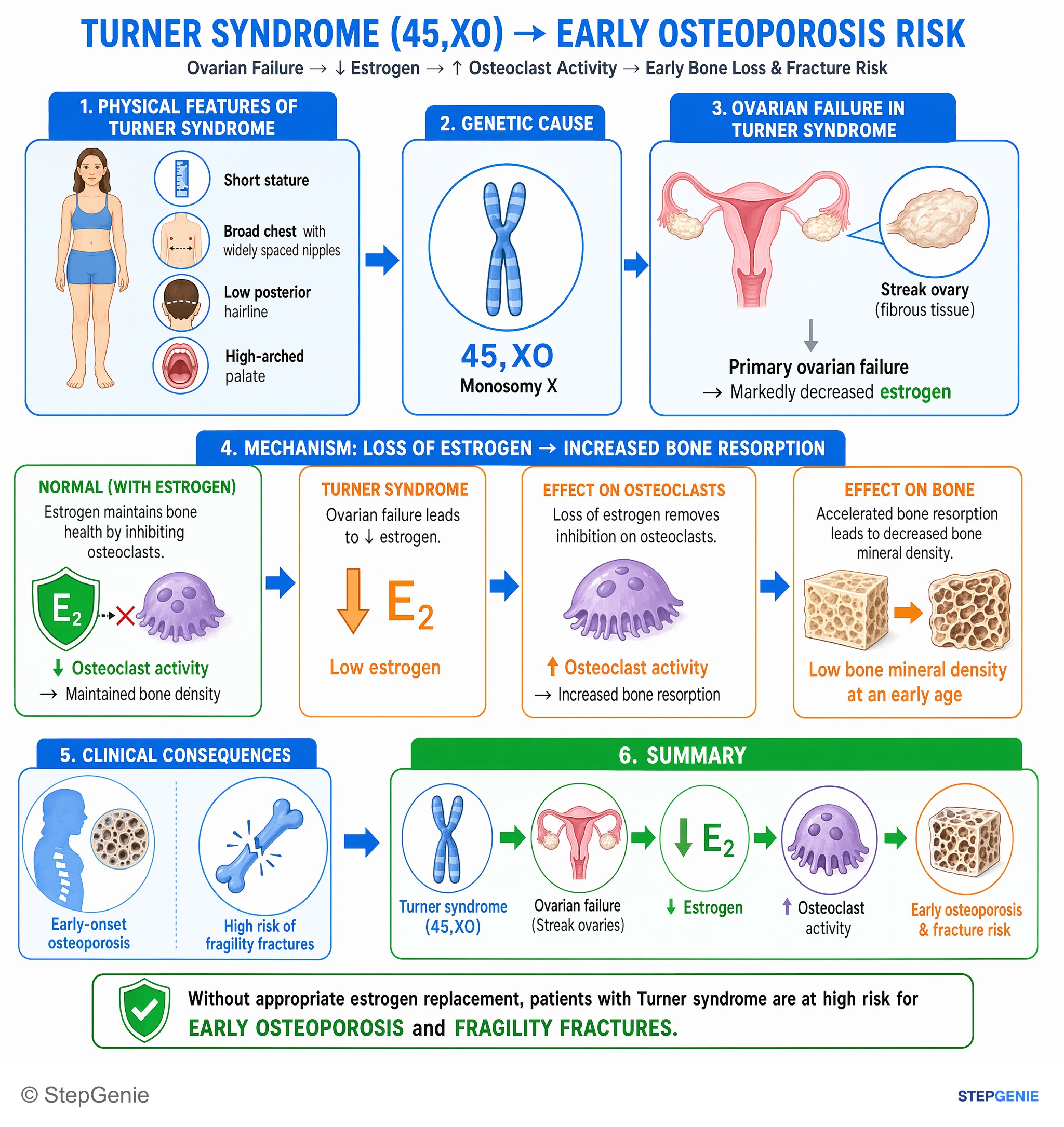 Step-by-step reasoning infographic: Turner syndrome (45,XO) with ovarian failure → ↓estrogen → ↑osteoclast activity → early osteoporosis and fracture risk.