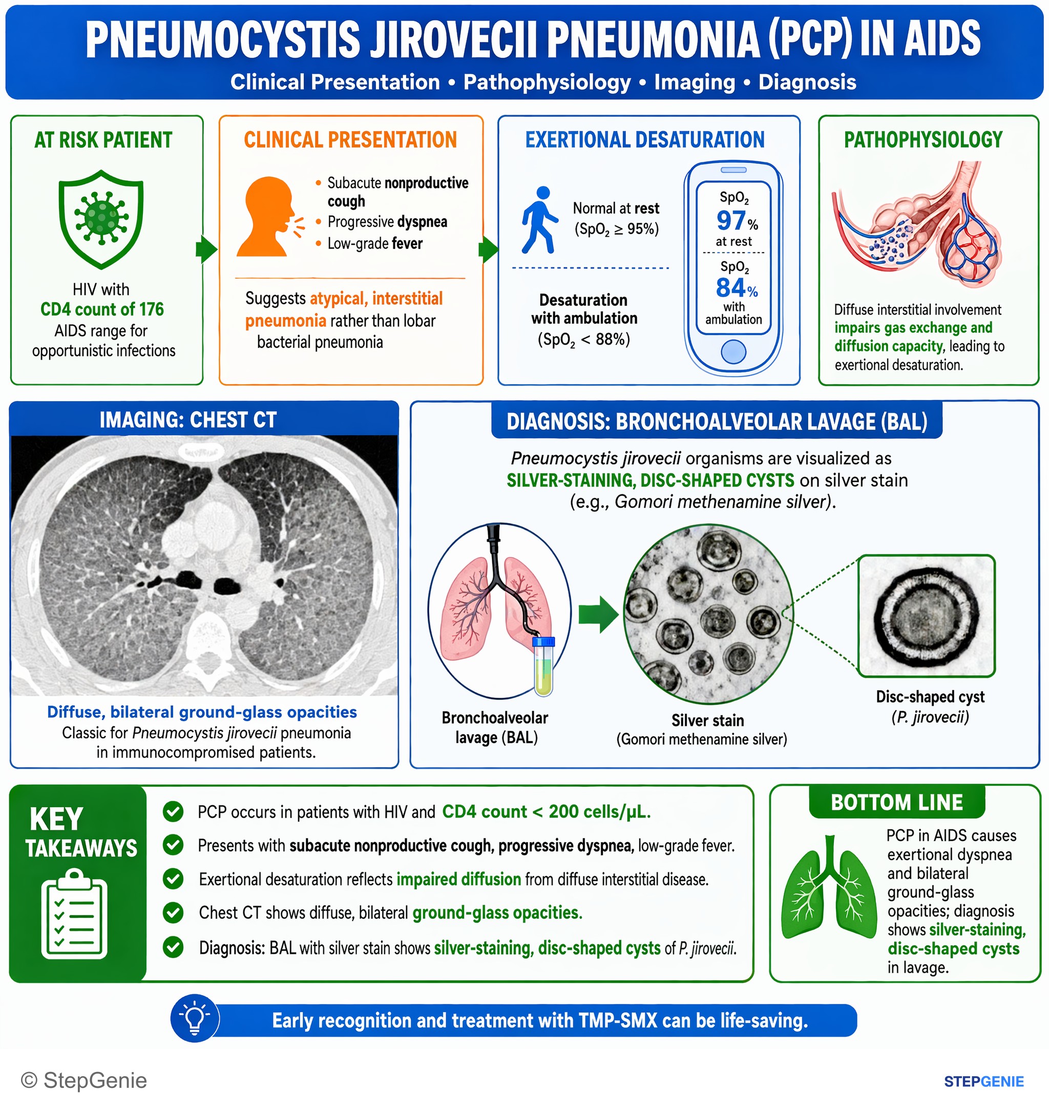 Pulmonary infections — StepGenie USMLE Step 1 explanation infographic