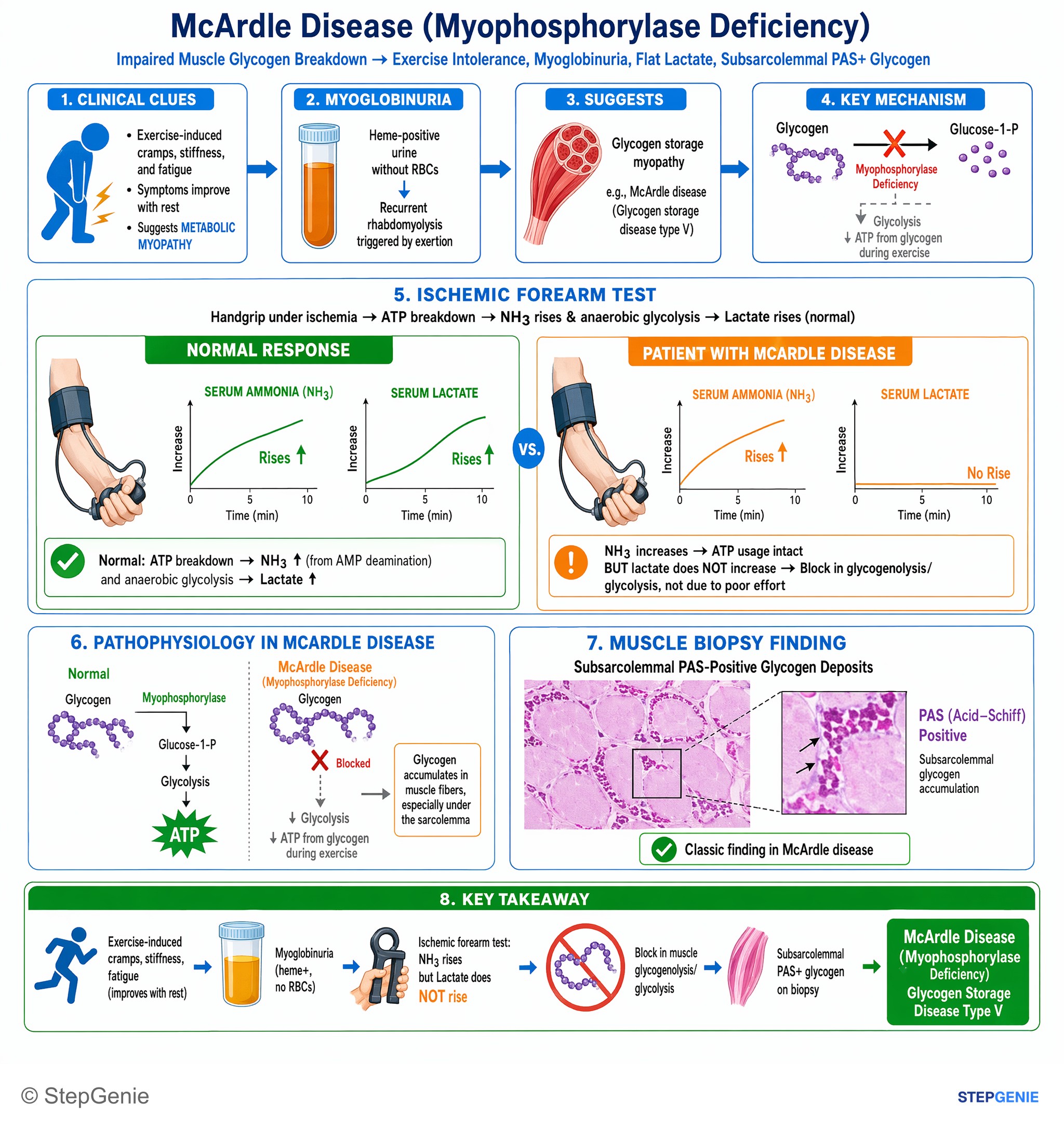Muscular disorders — StepGenie USMLE Step 1 explanation infographic