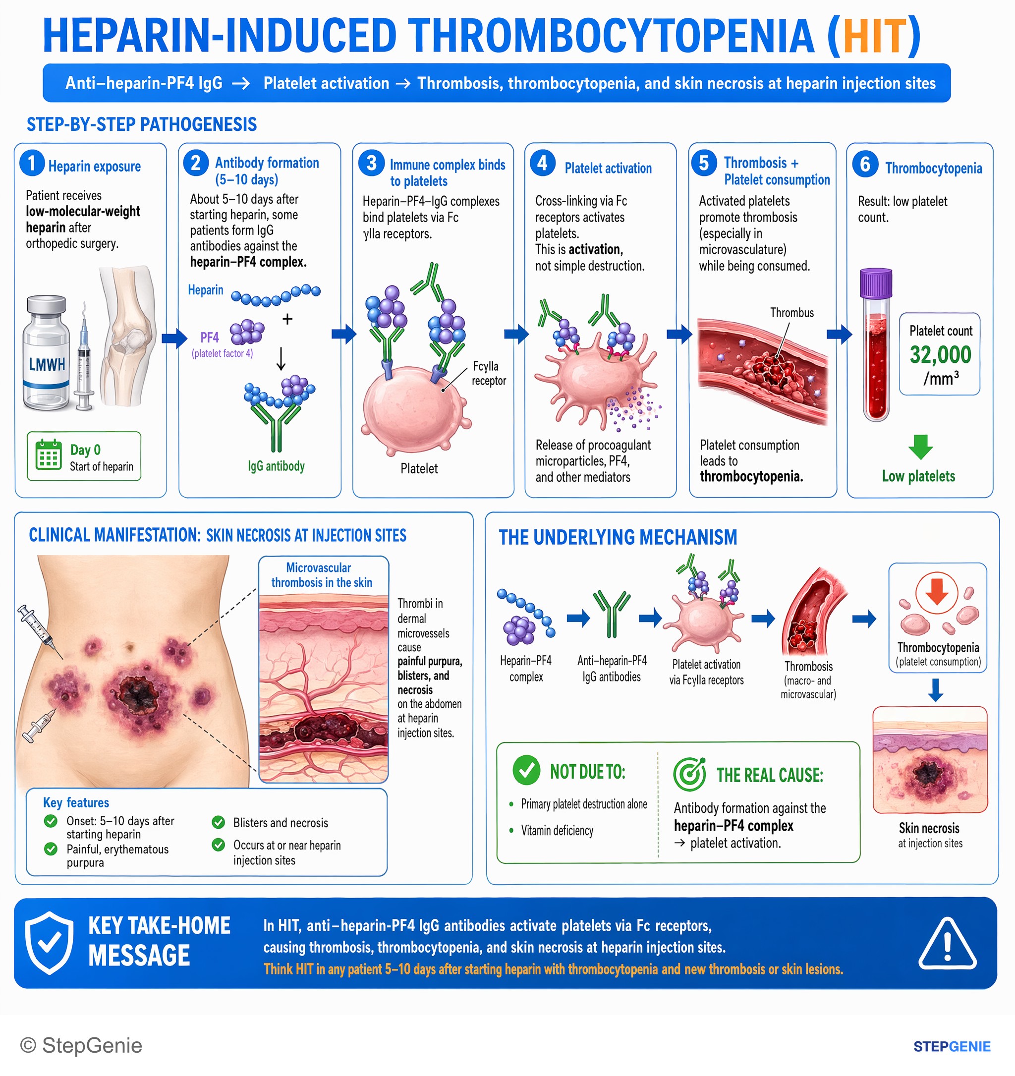 Platelet disorders — StepGenie USMLE Step 1 explanation infographic