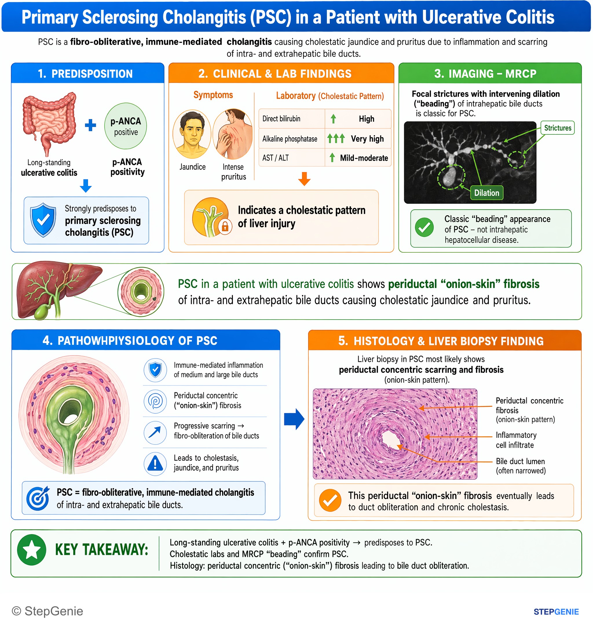 Hepatic disorders — StepGenie USMLE Step 1 explanation infographic