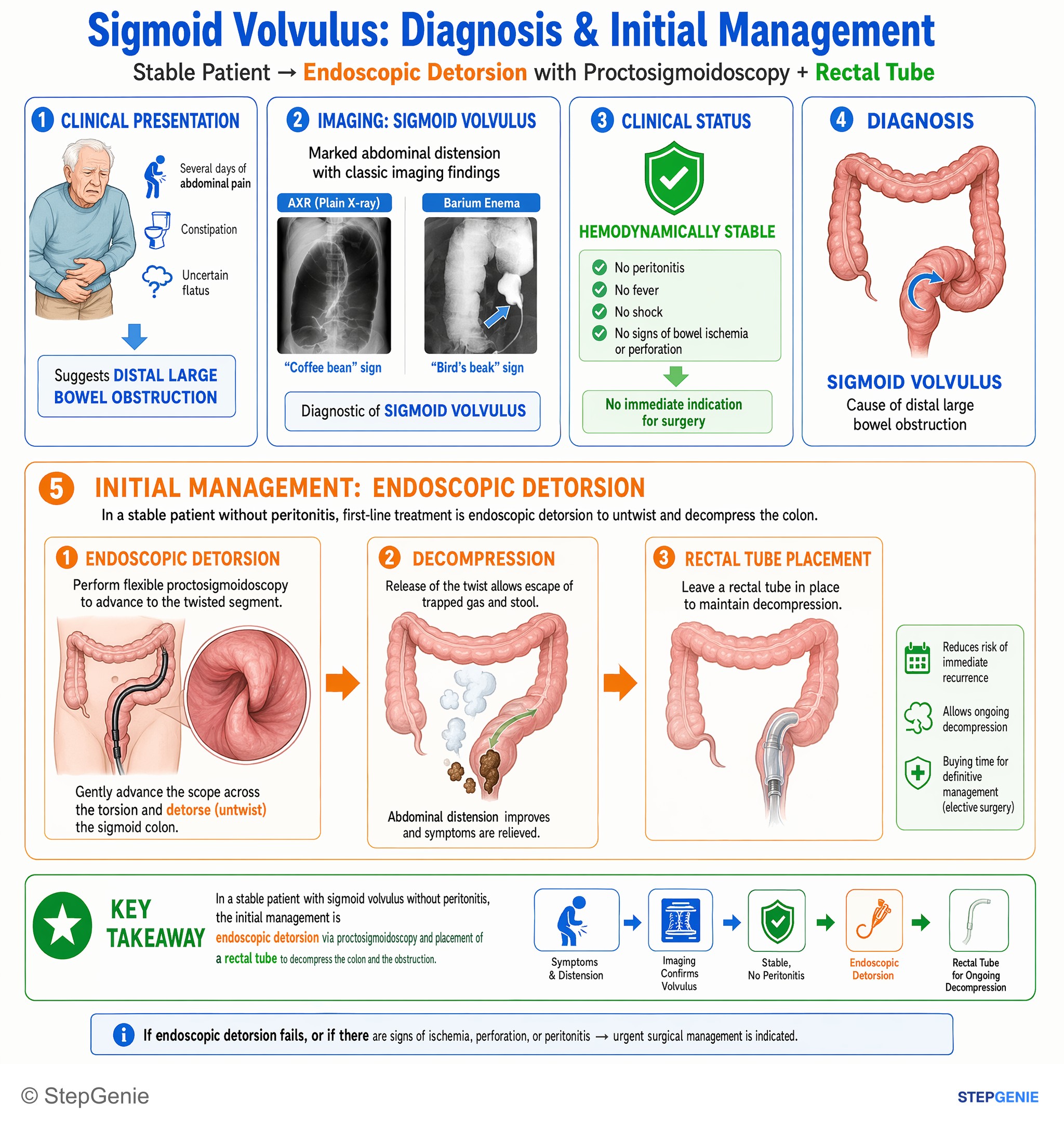 Intestinal and colorectal disorders — StepGenie USMLE Step 2 explanation infographic